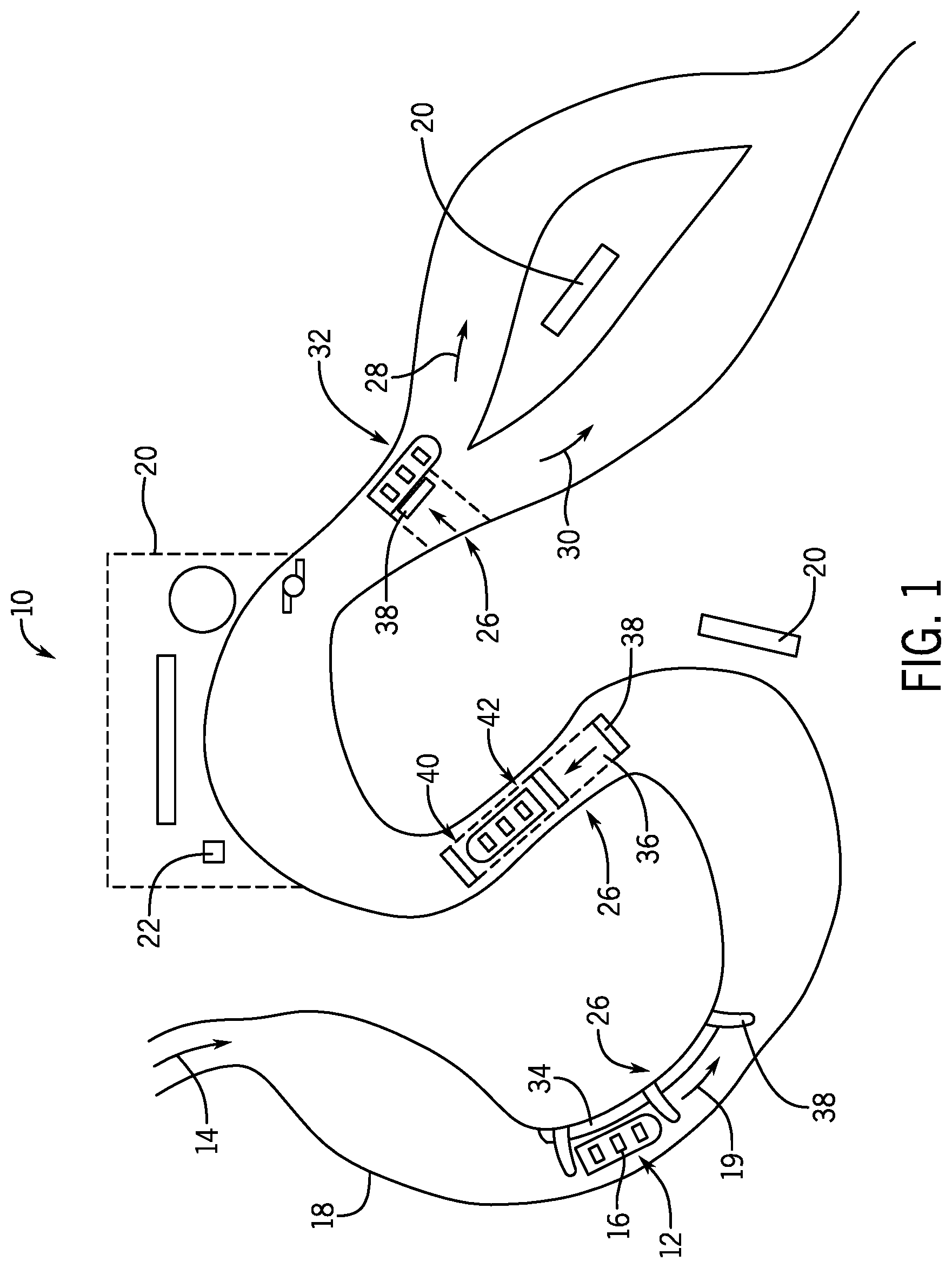 Patent US11779851 — Water amusement ride motion governor — Figure 1