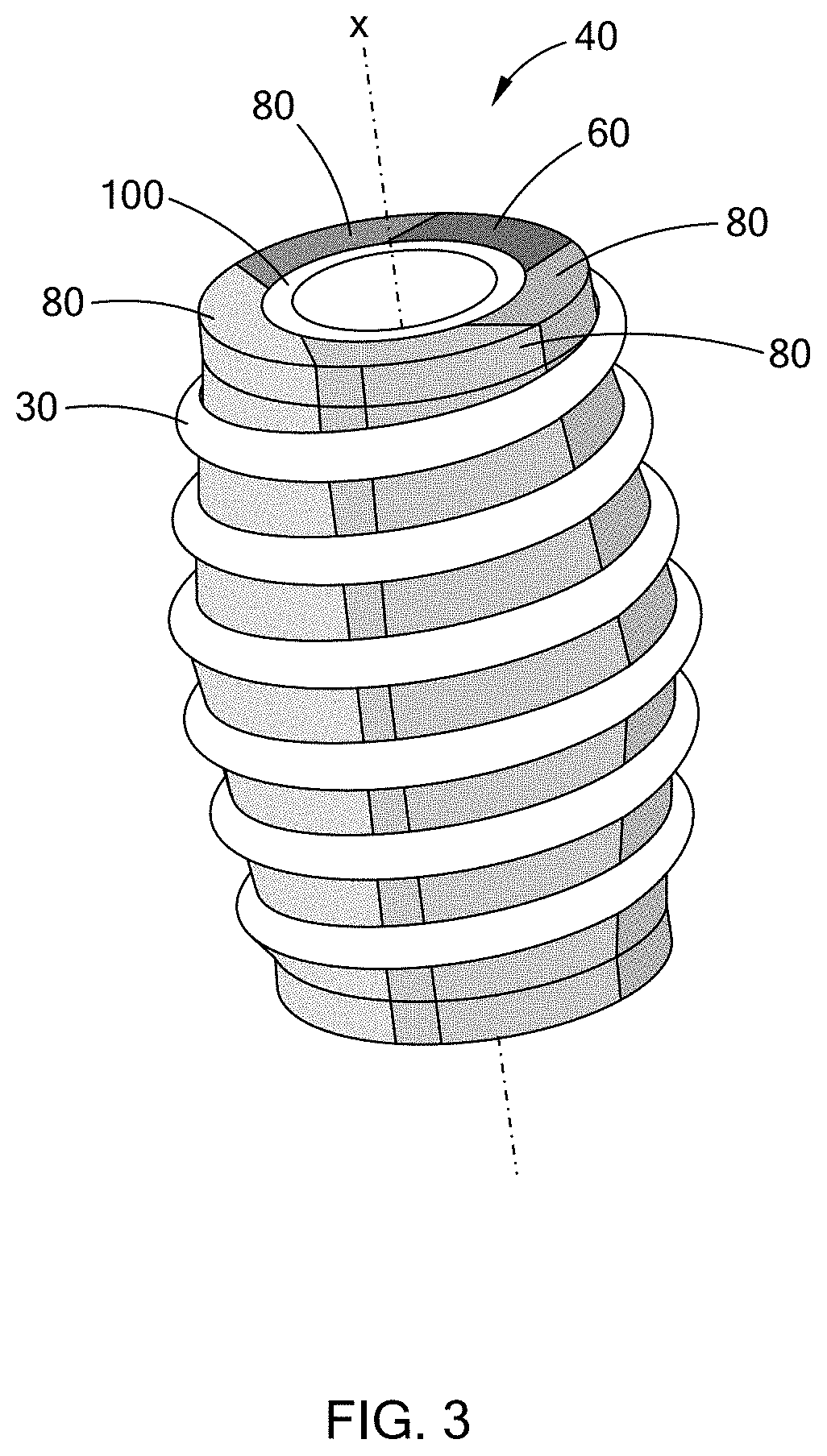 Patent US11780148 Figure 3 – Permanent tooling for composite coil spring compression molding