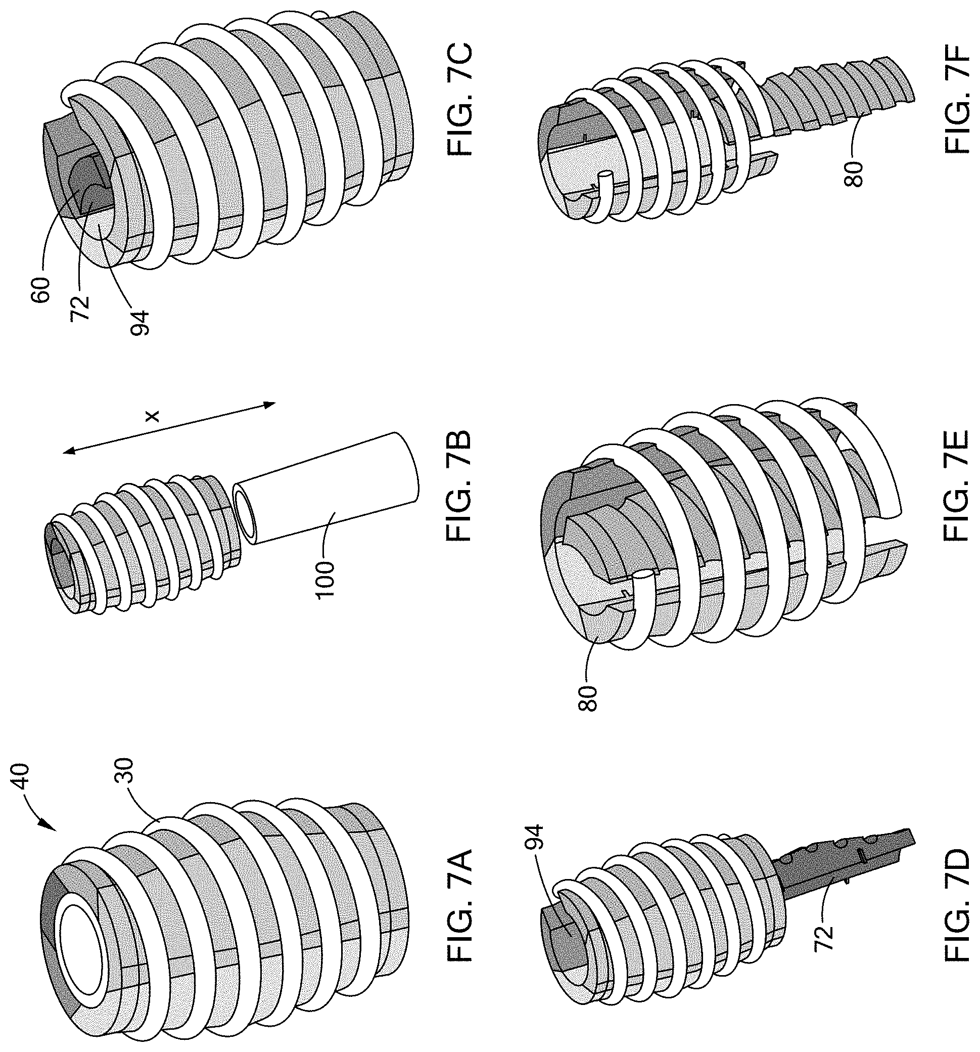 Patent US11780148 Figure 9 – Permanent tooling for composite coil spring compression molding