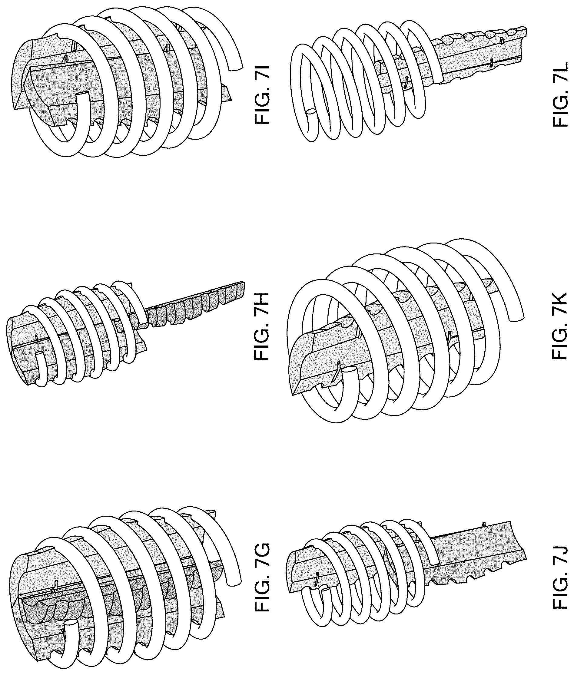 Patent US11780148 Figure 10 – Permanent tooling for composite coil spring compression molding