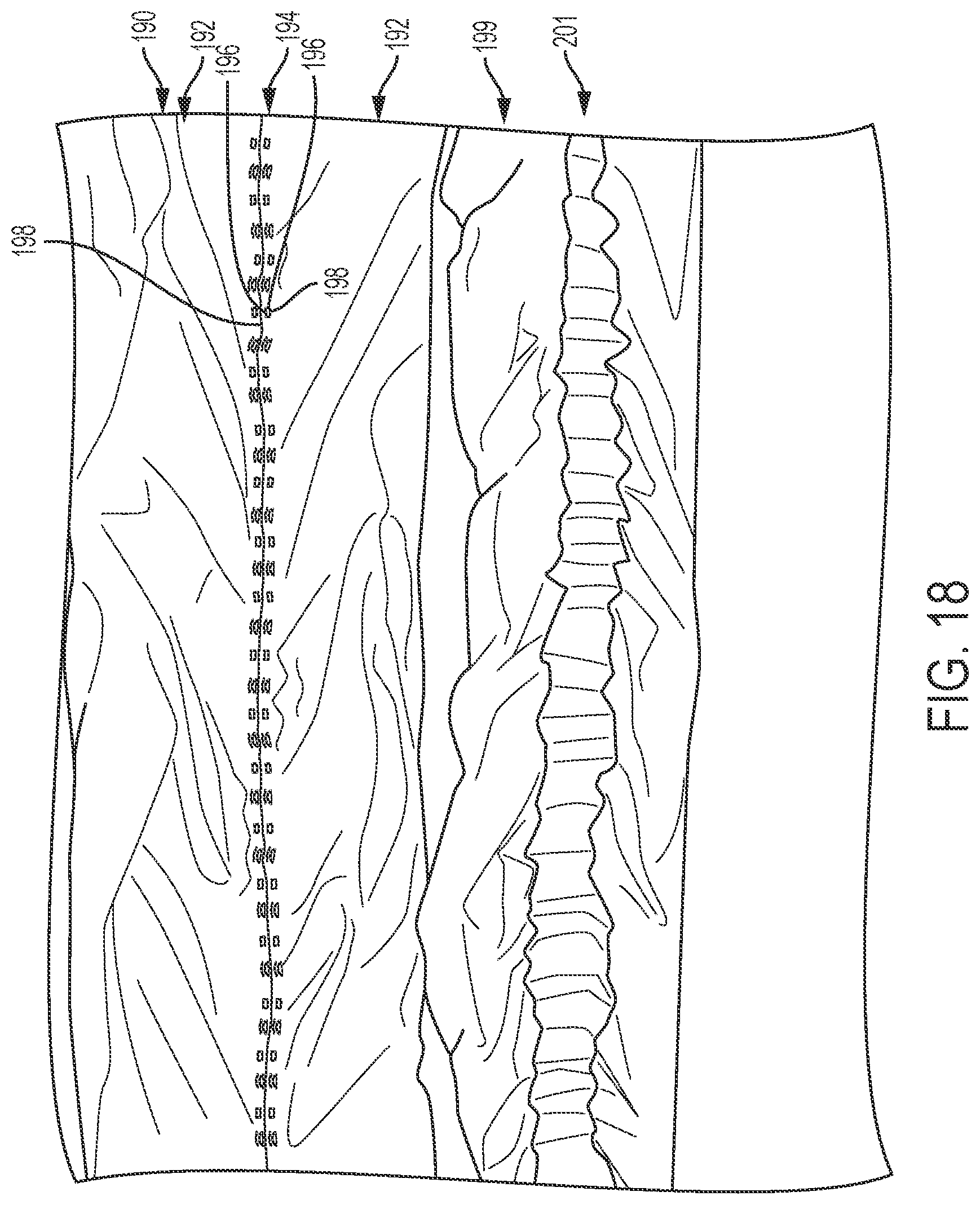 Patent US11780202 Figure 18 – Dunnage conversion machine and method