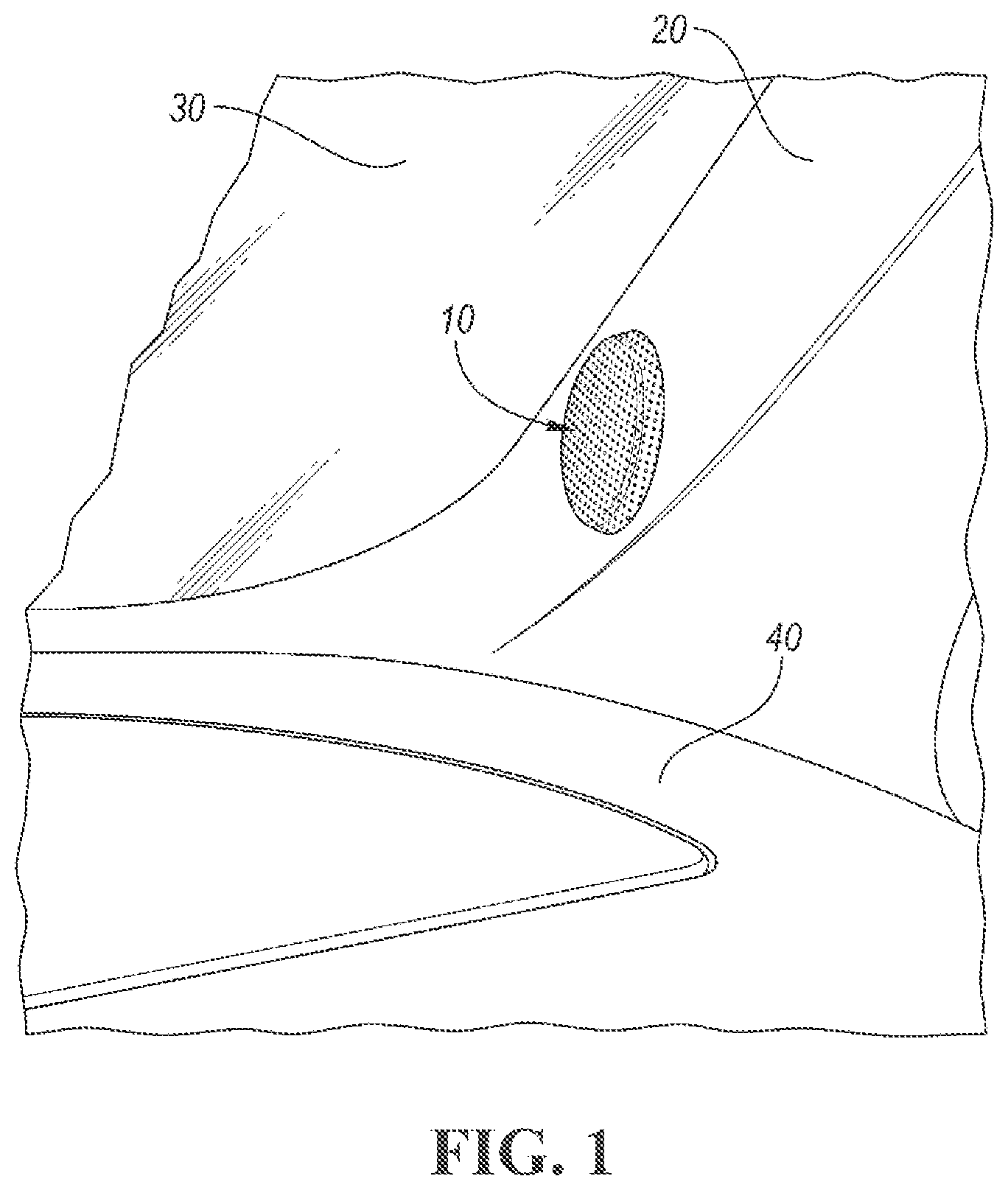 Patent US11780378 Figure 1 – Tweeter flush, surface, and starfish mount installation