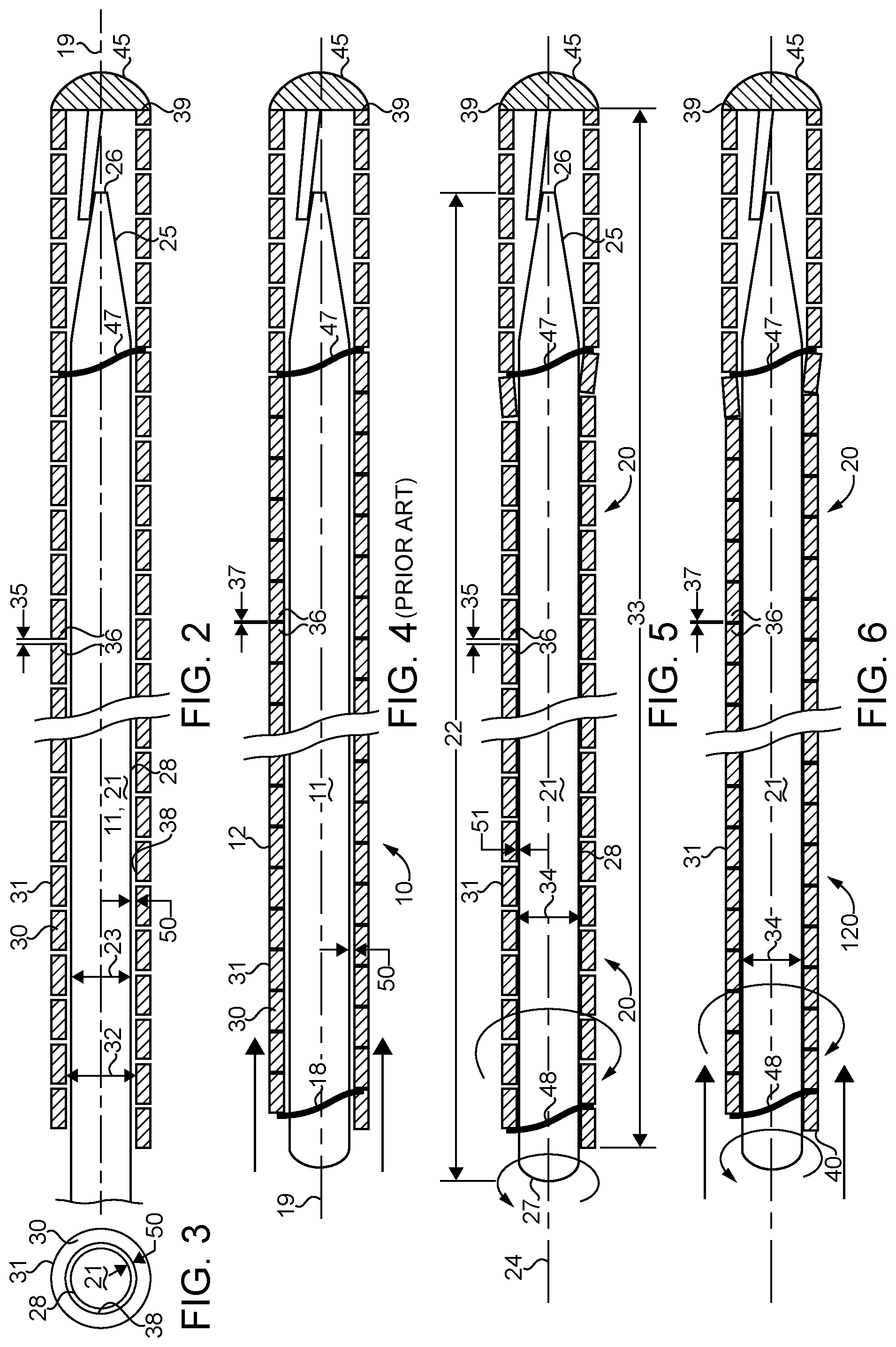 Patent US11780623 Figure 2 – Flat wire coil wire guide with twisted contraction