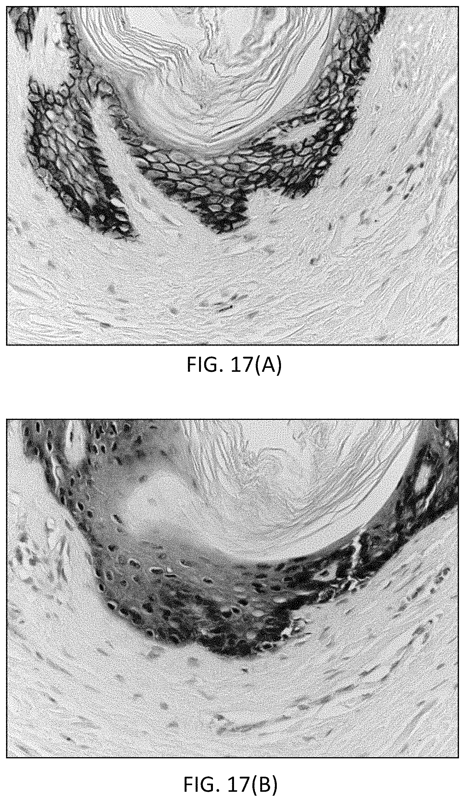 Patent US11780863 Figure 20 – Quinone methide analog signal amplification