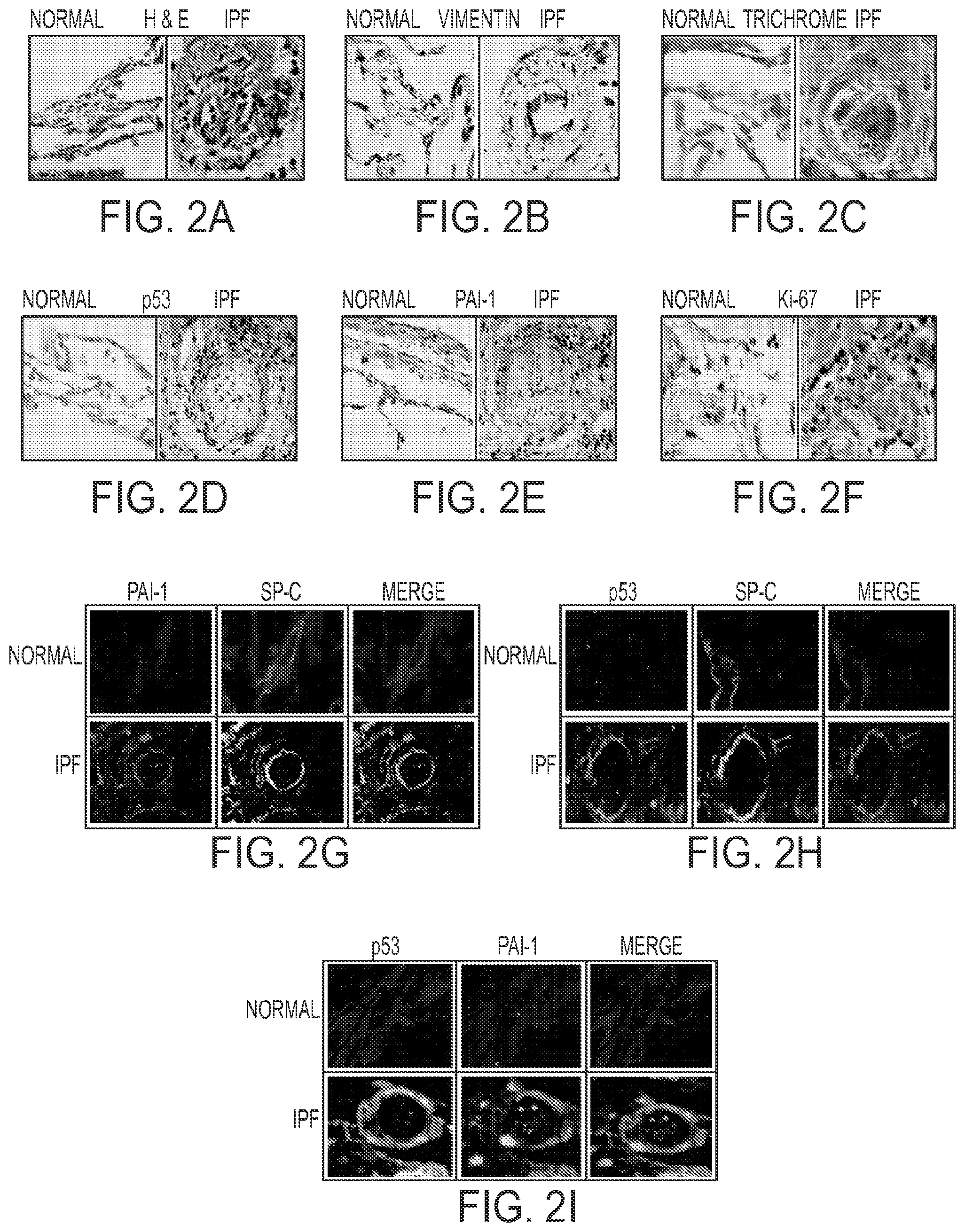 Patent US11780879 Figure 2 – Inhibition of pulmonary fibrosis with nutlin-3A and peptides