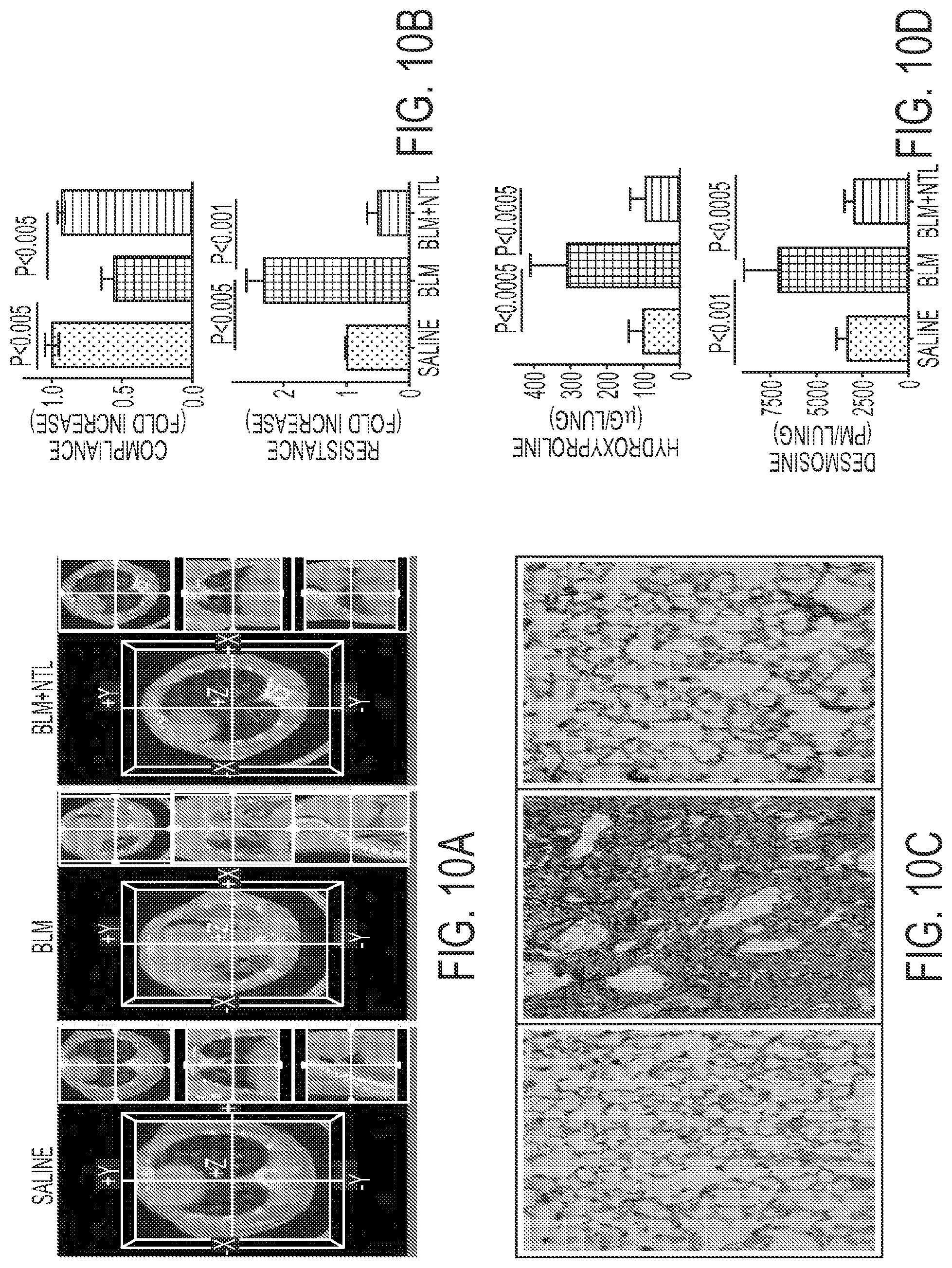Patent US11780879 Figure 10 – Inhibition of pulmonary fibrosis with nutlin-3A and peptides