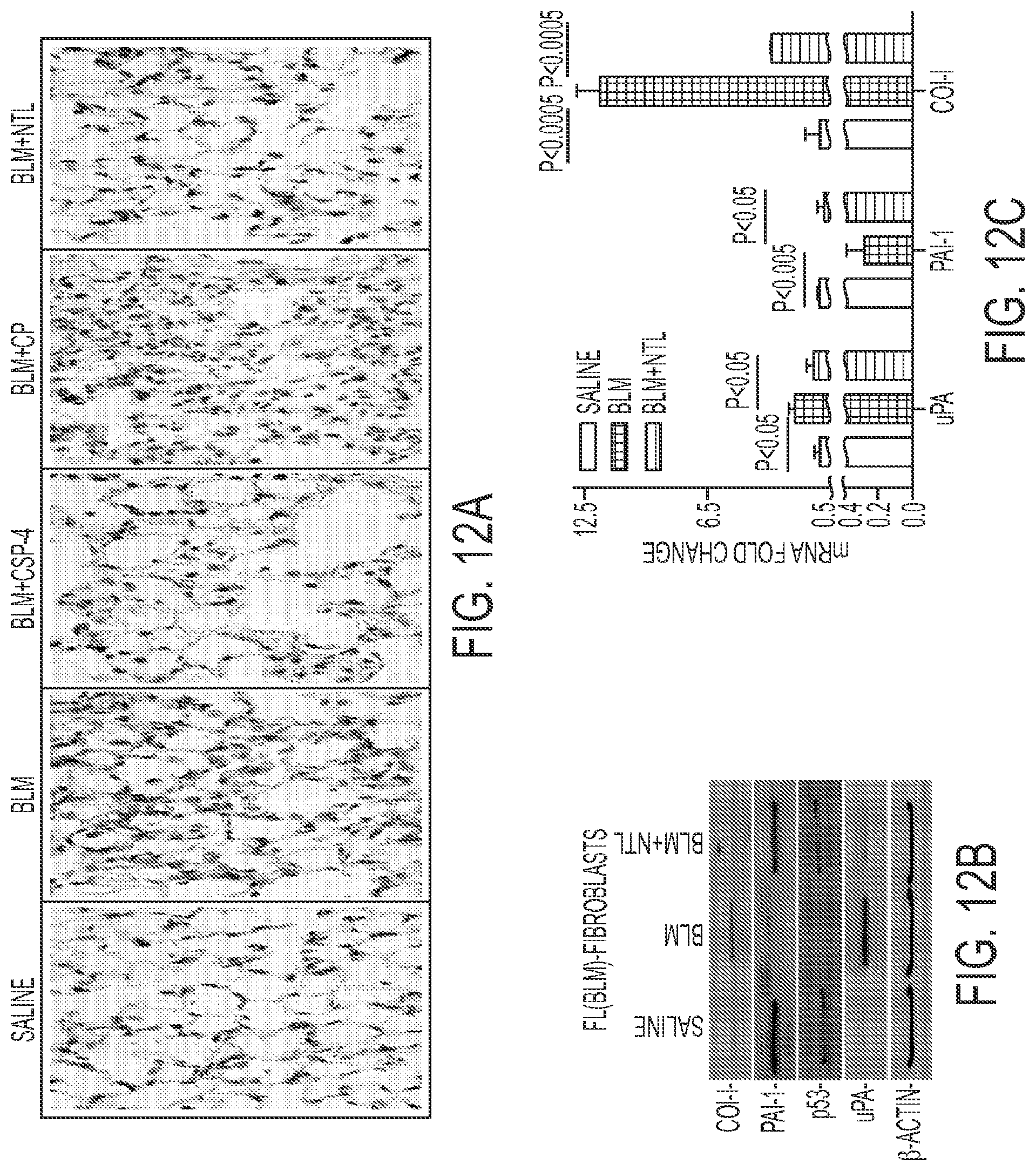 Patent US11780879 Figure 12 – Inhibition of pulmonary fibrosis with nutlin-3A and peptides