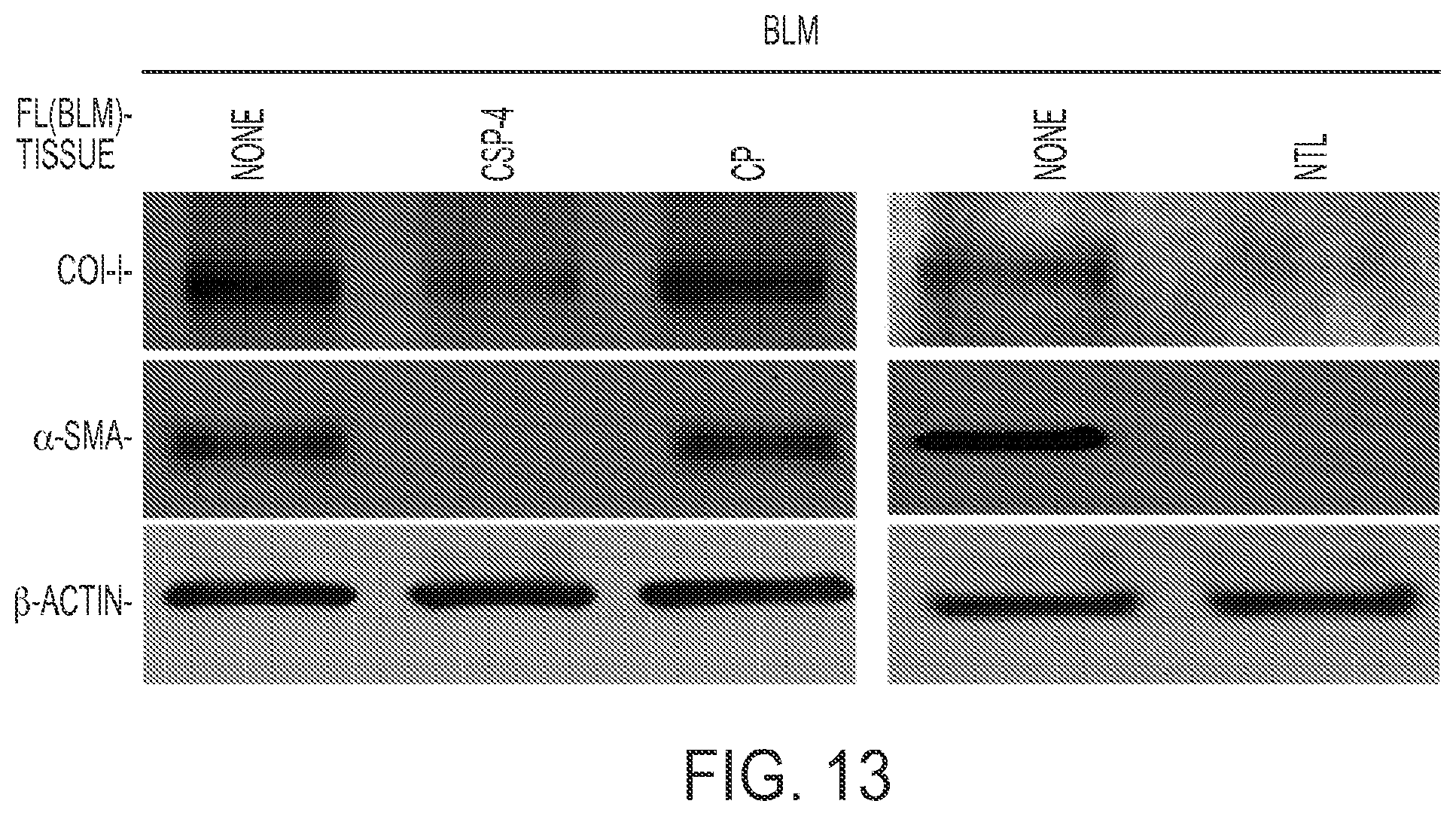 Patent US11780879 Figure 13 – Inhibition of pulmonary fibrosis with nutlin-3A and peptides