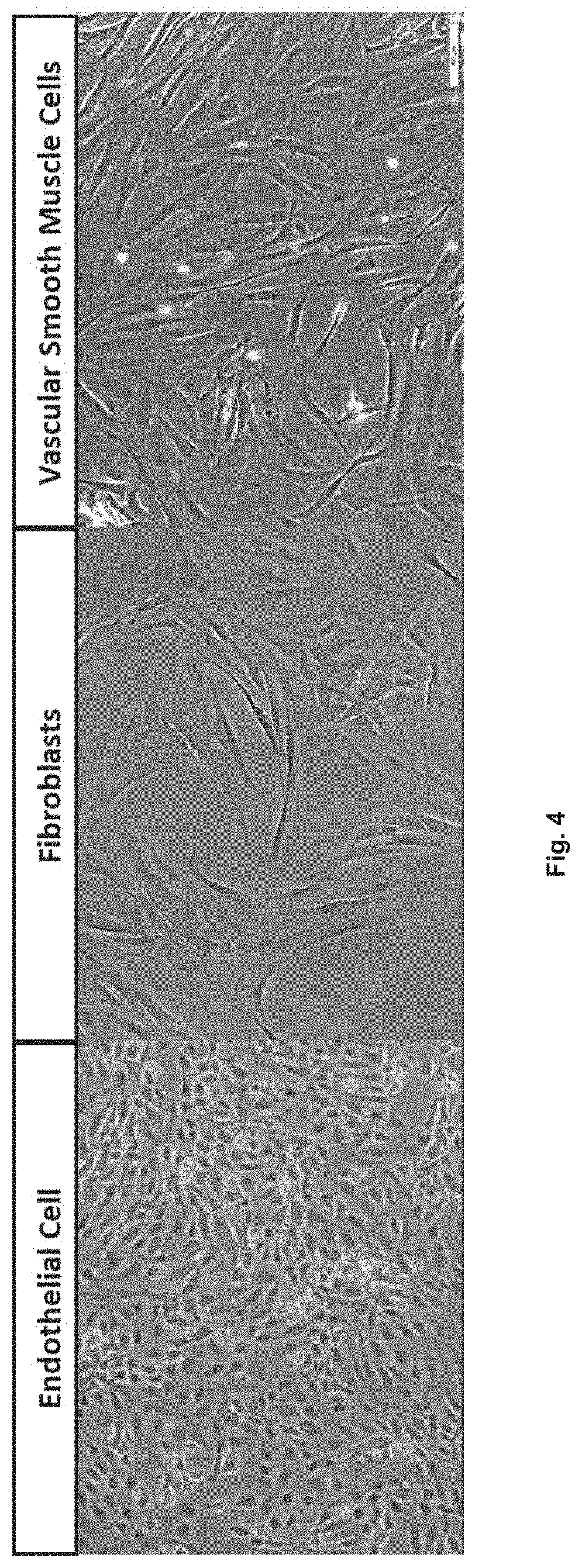 Patent US11780898 Figure 4 – Treatment of SMC mediated disease
