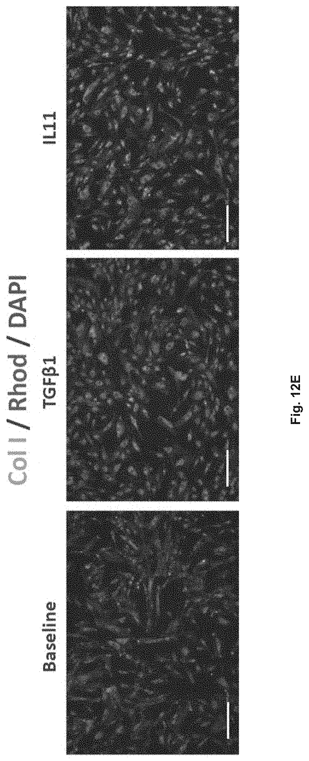 Patent US11780898 Figure 12 – Treatment of SMC mediated disease