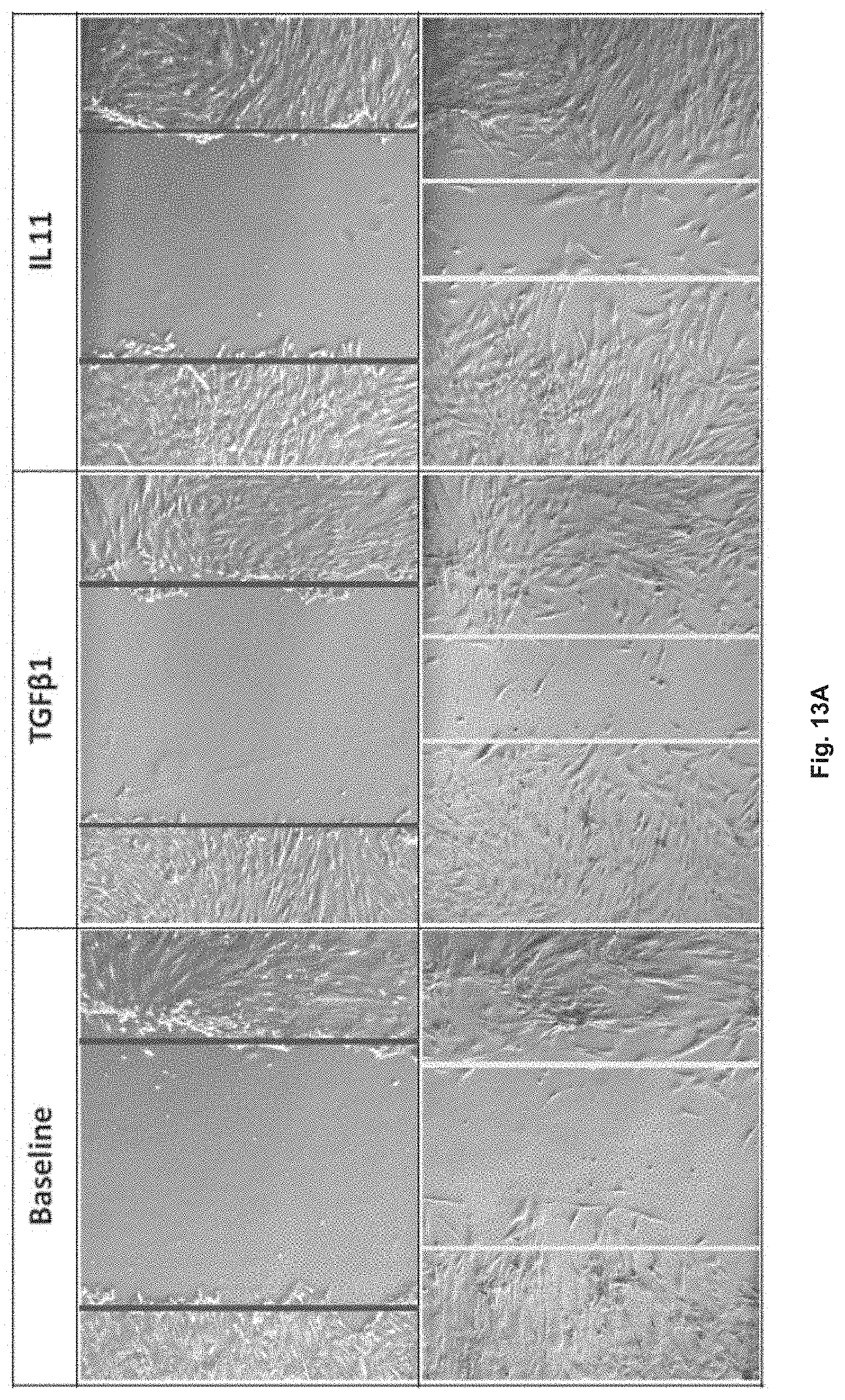 Patent US11780898 Figure 13 – Treatment of SMC mediated disease