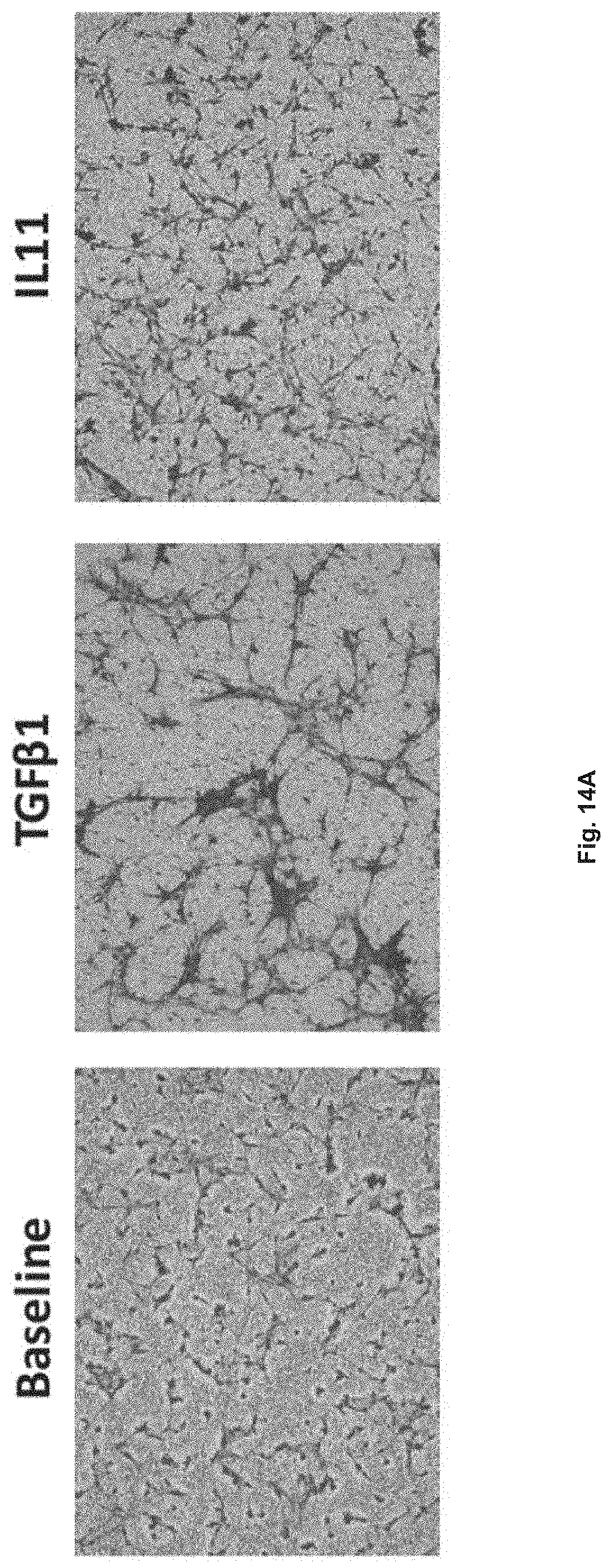 Patent US11780898 Figure 15 – Treatment of SMC mediated disease