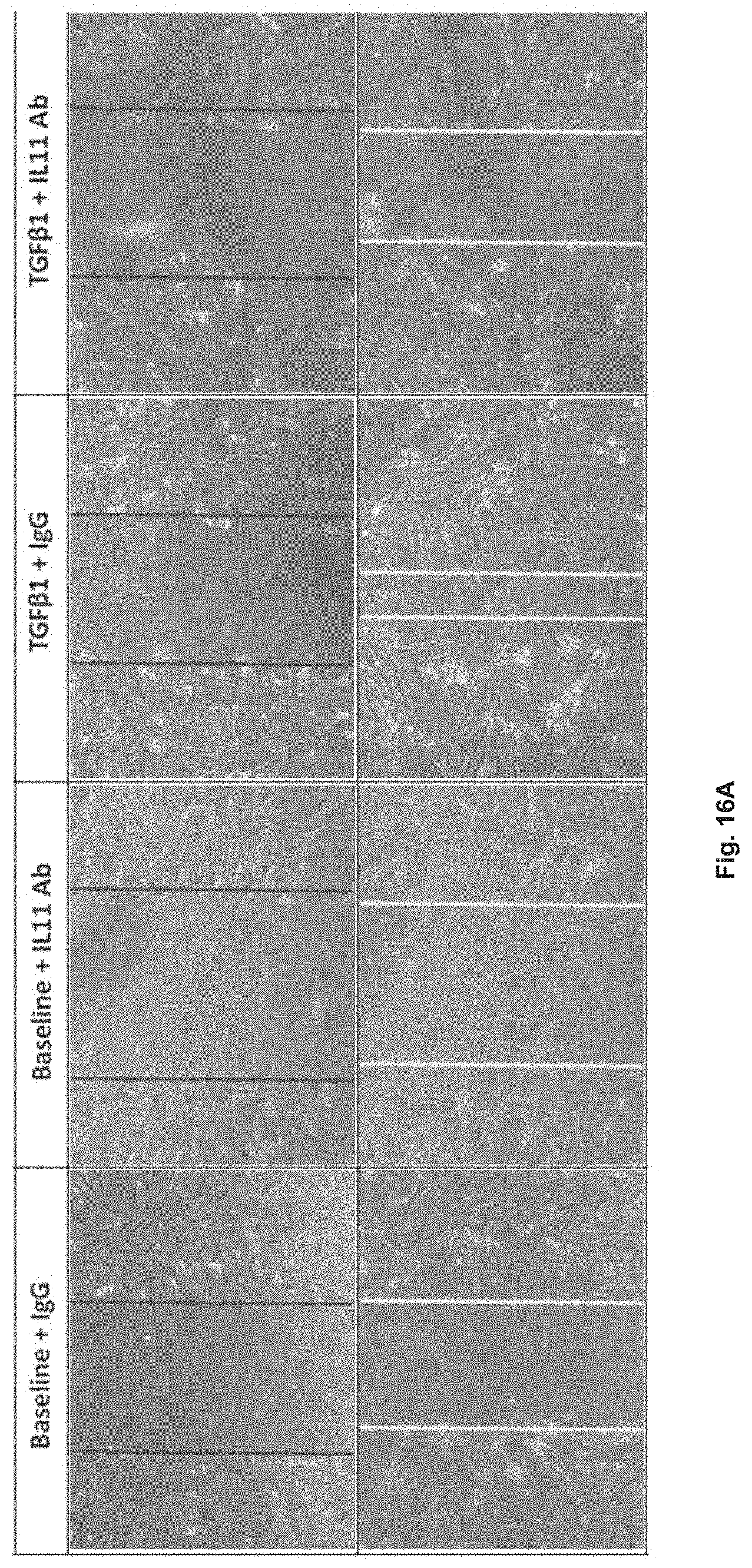 Patent US11780898 Figure 18 – Treatment of SMC mediated disease