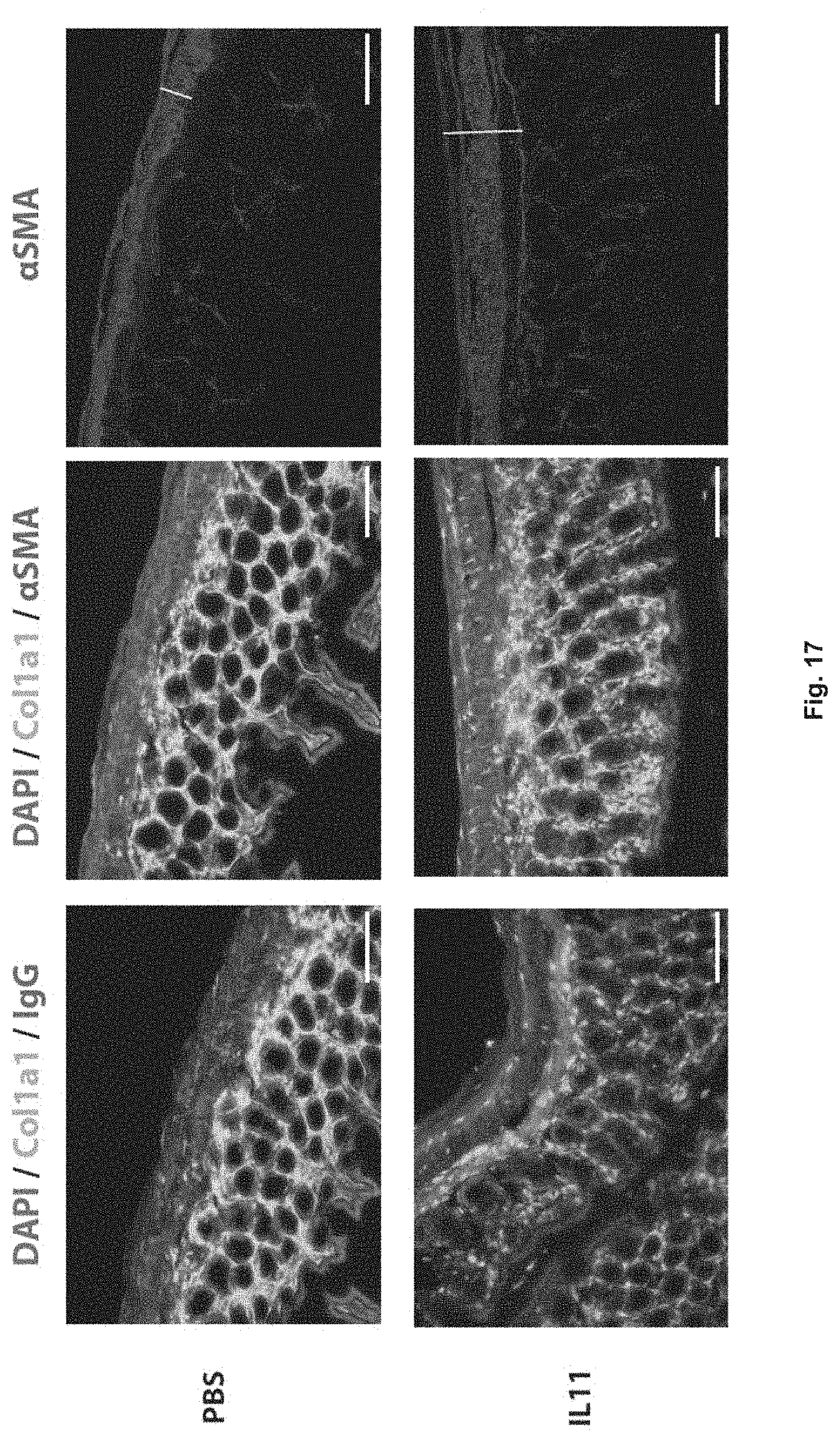 Patent US11780898 Figure 20 – Treatment of SMC mediated disease