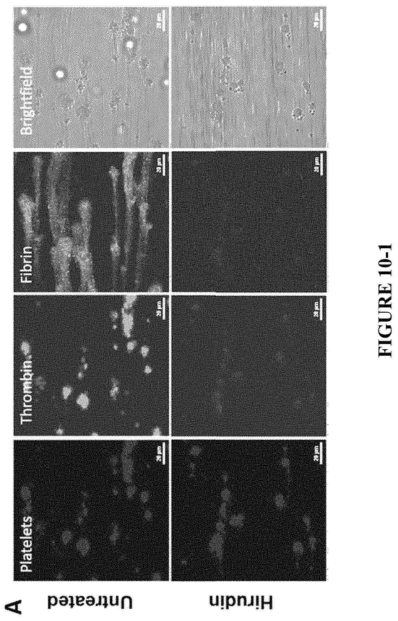 Patent US11780915 Figure 10 – Binding proteins to the human thrombin receptor, PAR4