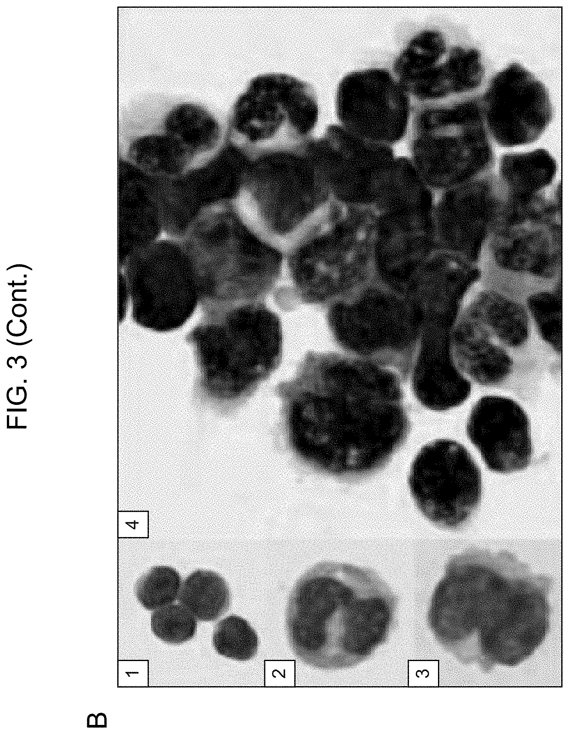 Patent US11780918 Figure 5 – Markers of acute myeloid leukemia stem cells