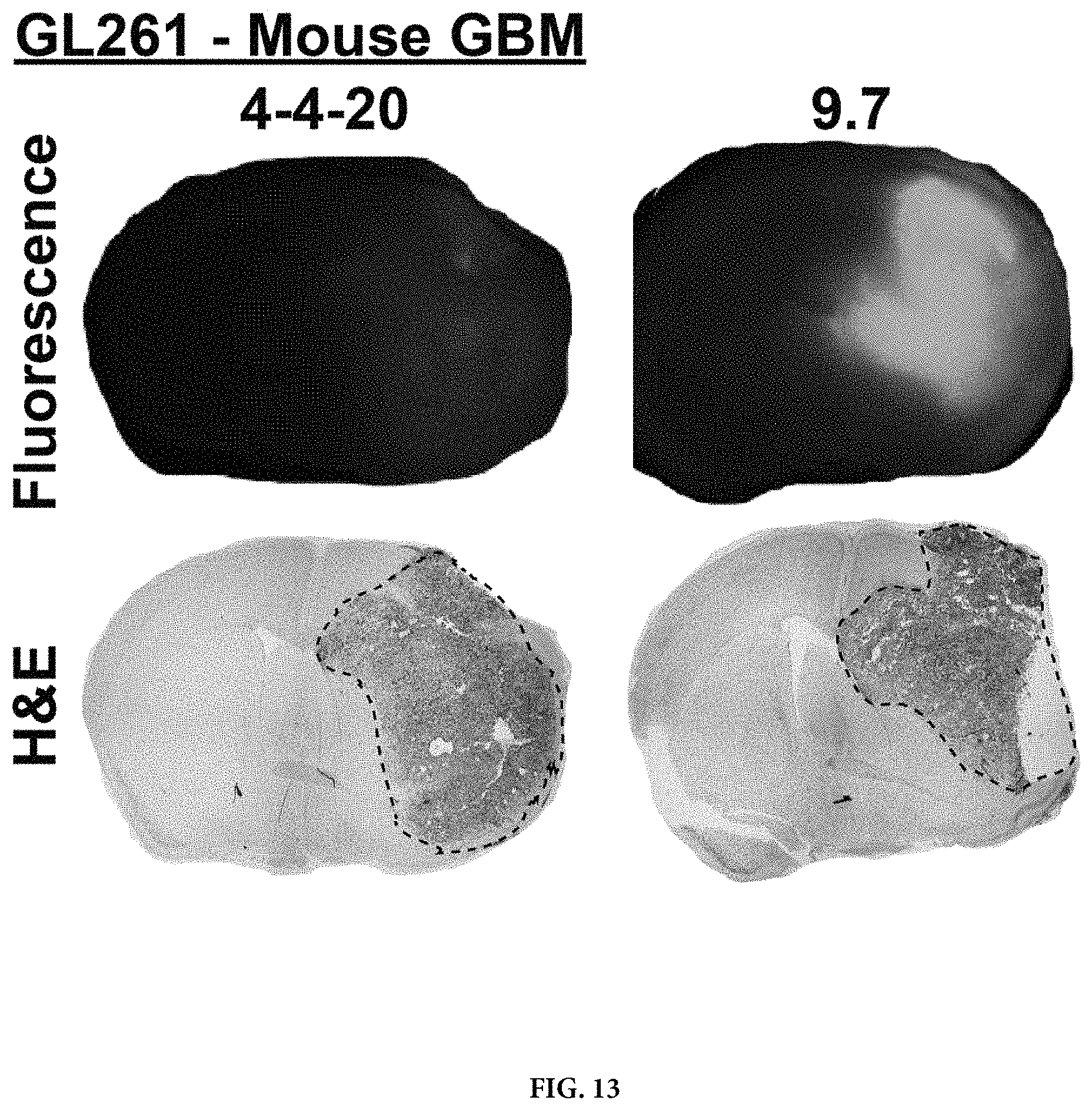 Patent US11780932 Figure 17 – Antibodies targeting glioblastoma stem-like cells and methods of use thereof
