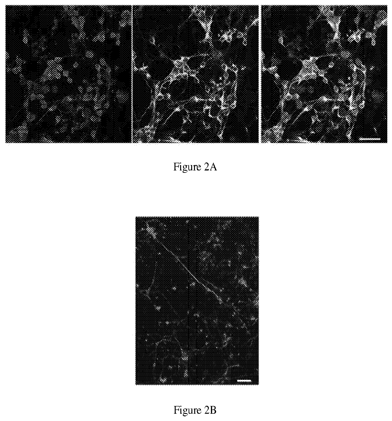 Patent US11781110 Figure 3 – Induction of corneal endothelial cells