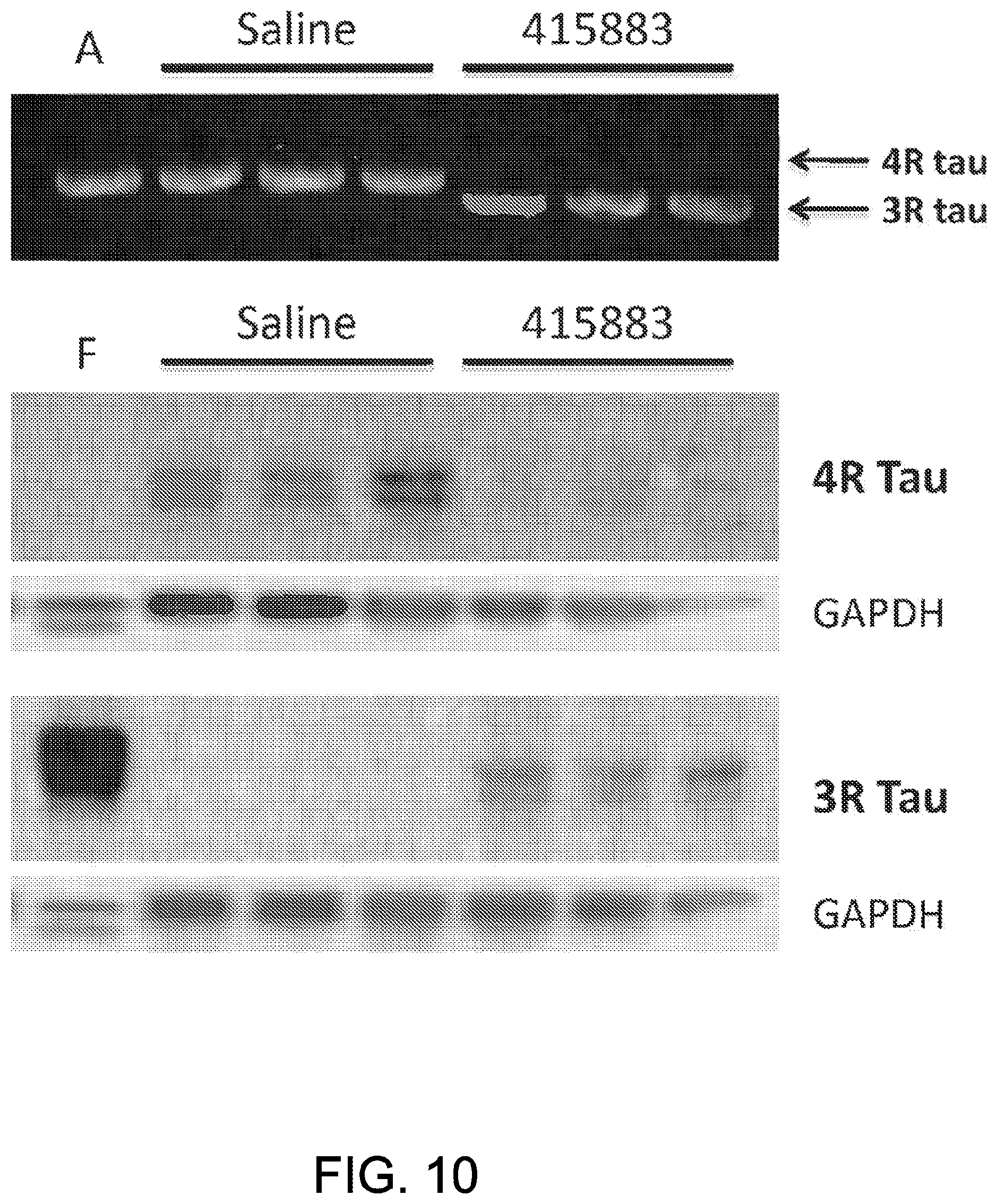 Patent US11781135 Figure 12 – Methods for treating Alzheimer's disease