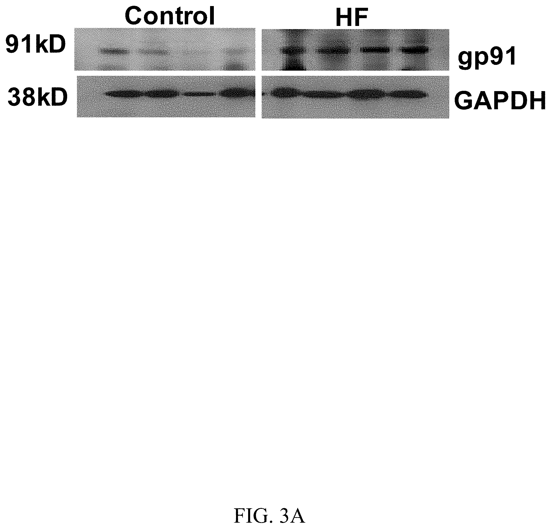 Patent US11781144 Figure 4 – Inhibition of oxidative stress in atrial fibrillation