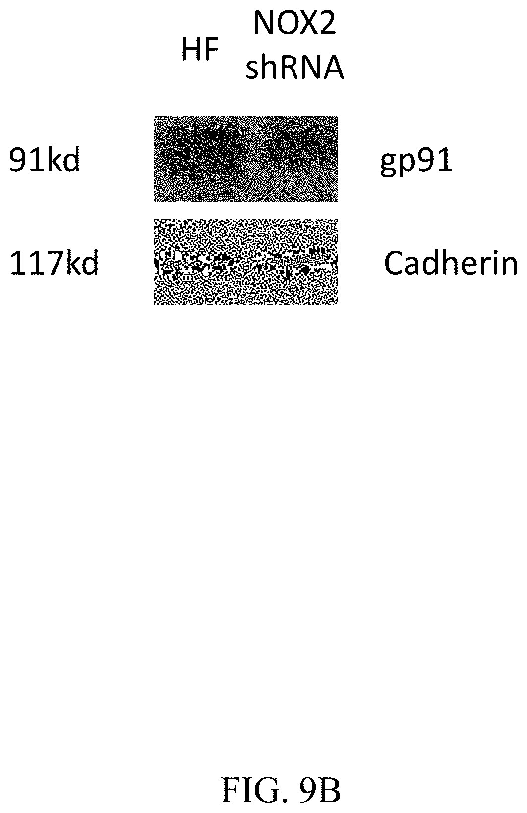Patent US11781144 Figure 16 – Inhibition of oxidative stress in atrial fibrillation