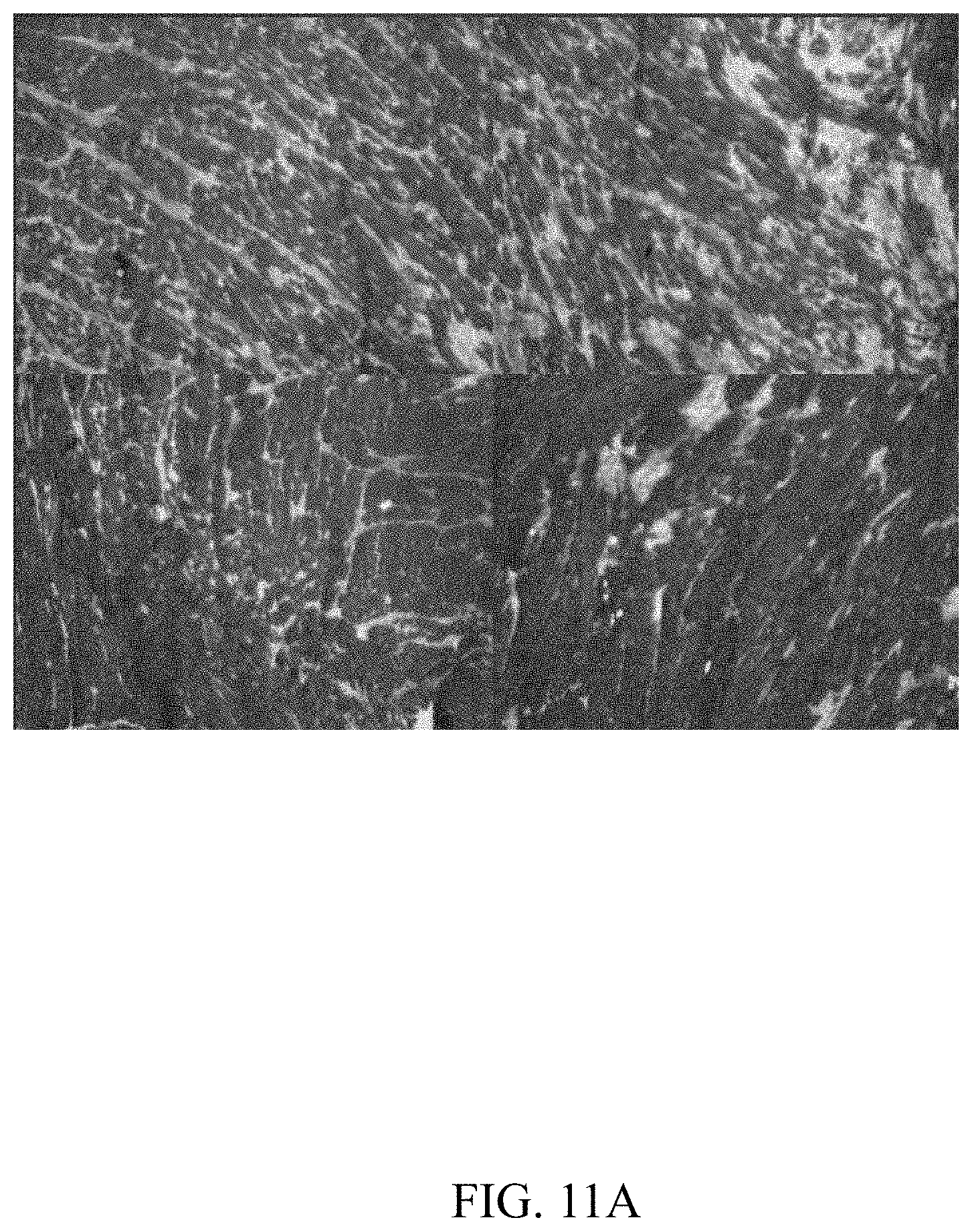 Patent US11781144 Figure 18 – Inhibition of oxidative stress in atrial fibrillation