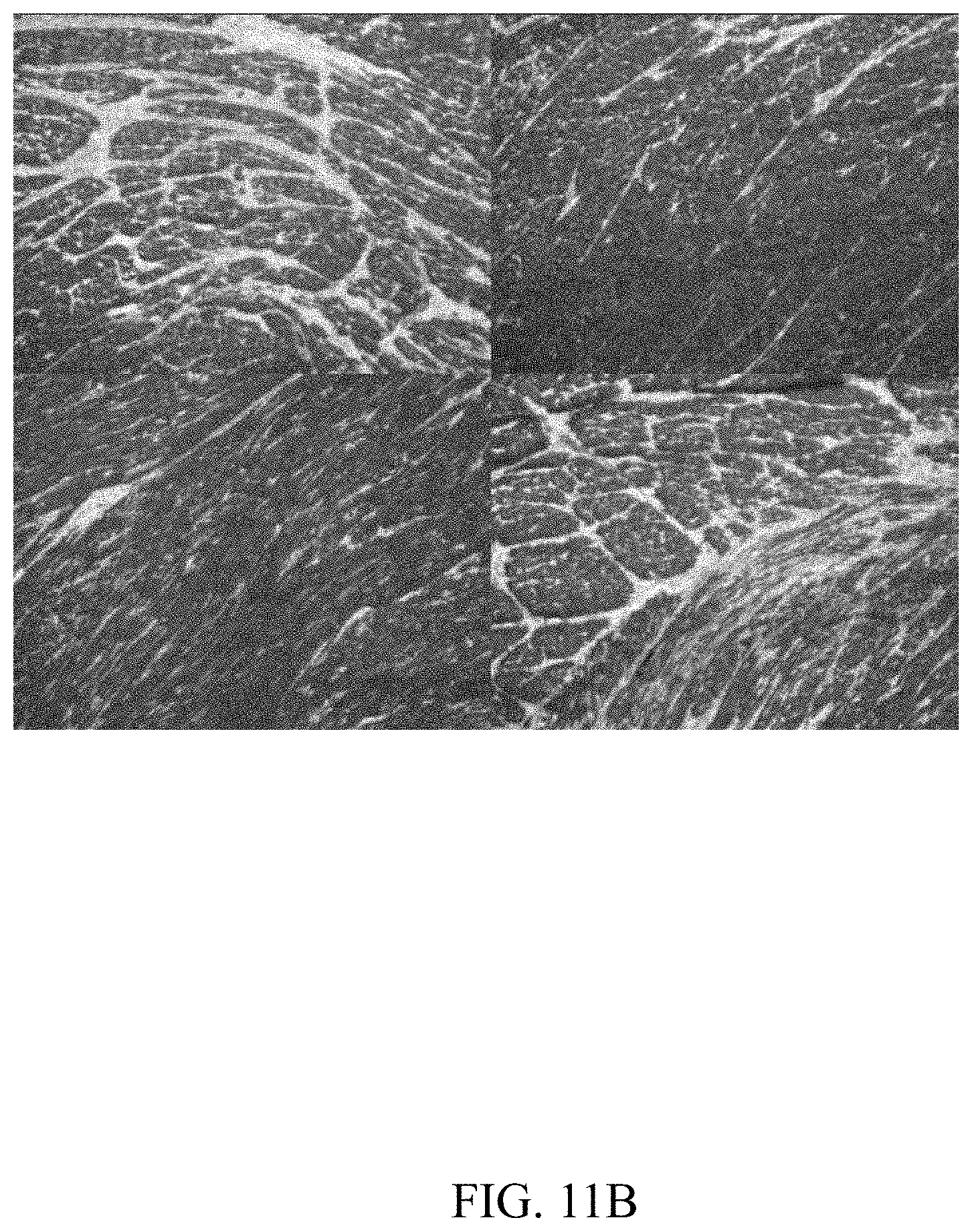 Patent US11781144 Figure 19 – Inhibition of oxidative stress in atrial fibrillation
