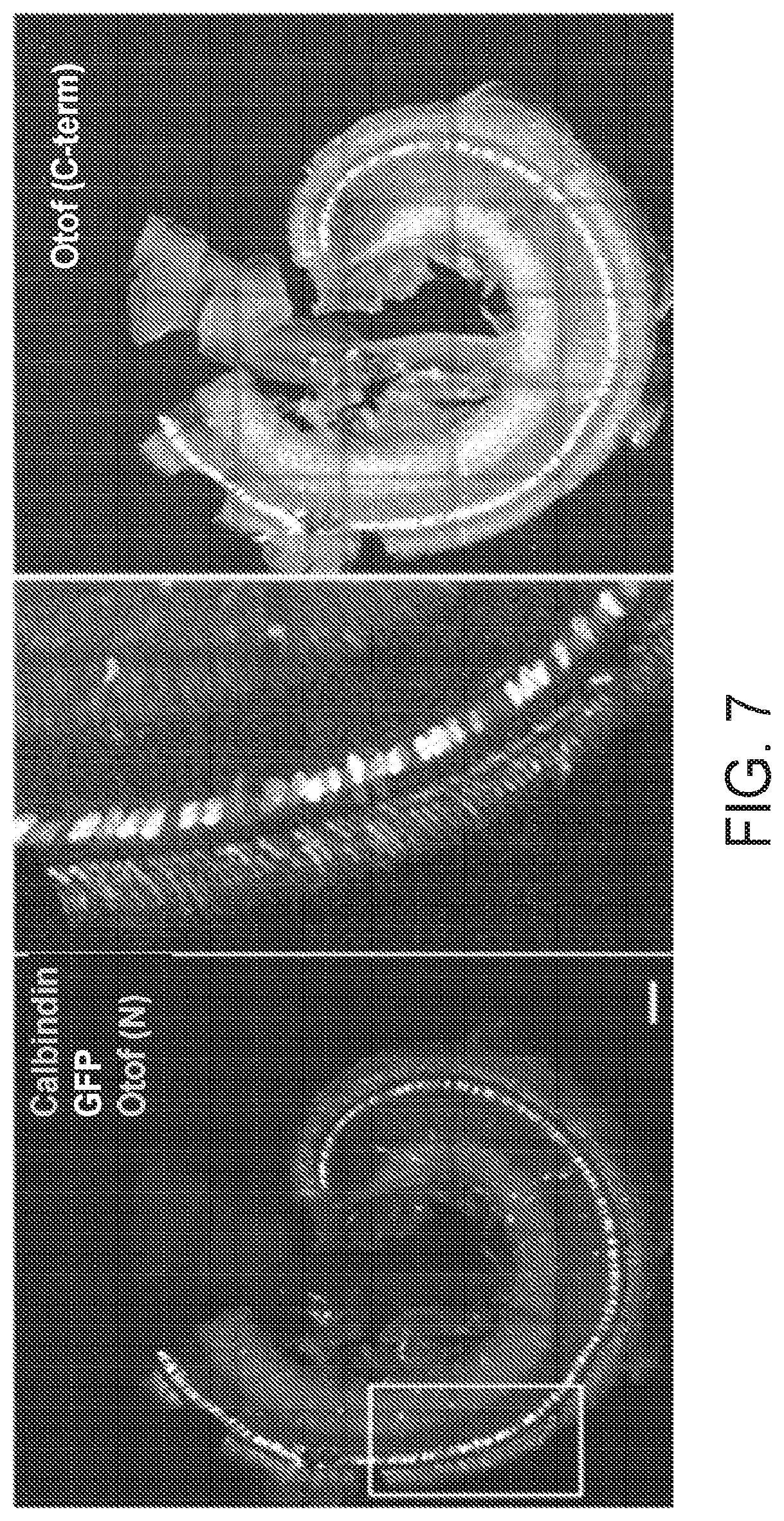 Patent US11781145 Figure 5 – Compositions and methods for treating non-age-associated hearing impairment in a human subject