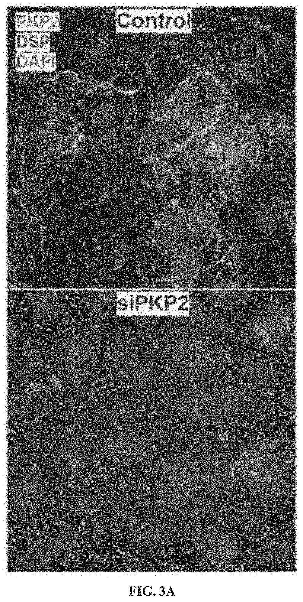 Patent US11781156 Figure 2 – Plakophillin-2 gene therapy methods and compositions