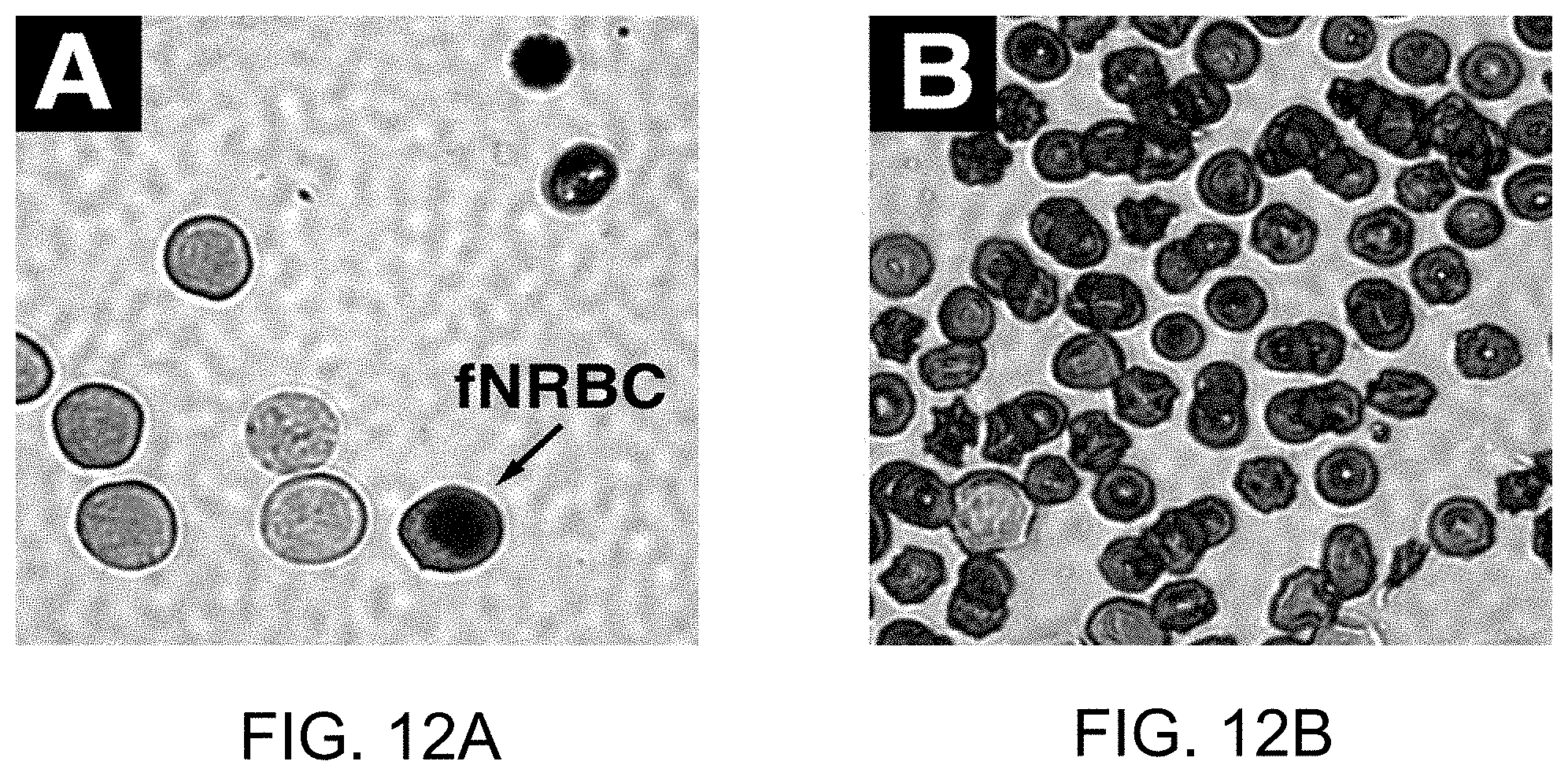 Patent US11781187 Figure 18 – Rare cell analysis using sample splitting and DNA tags