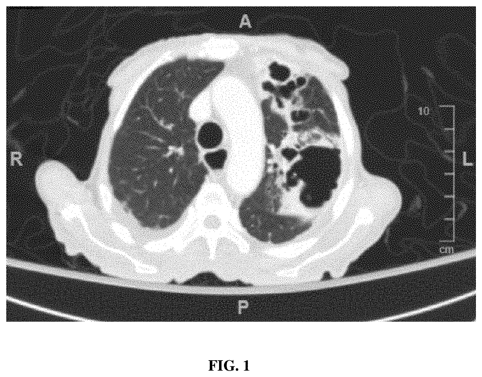 Patent US11781191 — Compositions and method for detecting Mycobacterium riyadhense — Figure 1