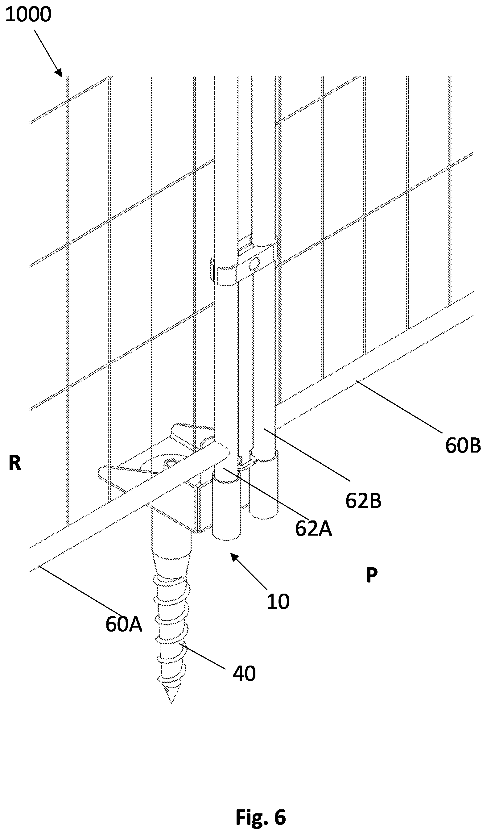 Patent US11781338 Figure 4 – Fence bracket and fence bracket system