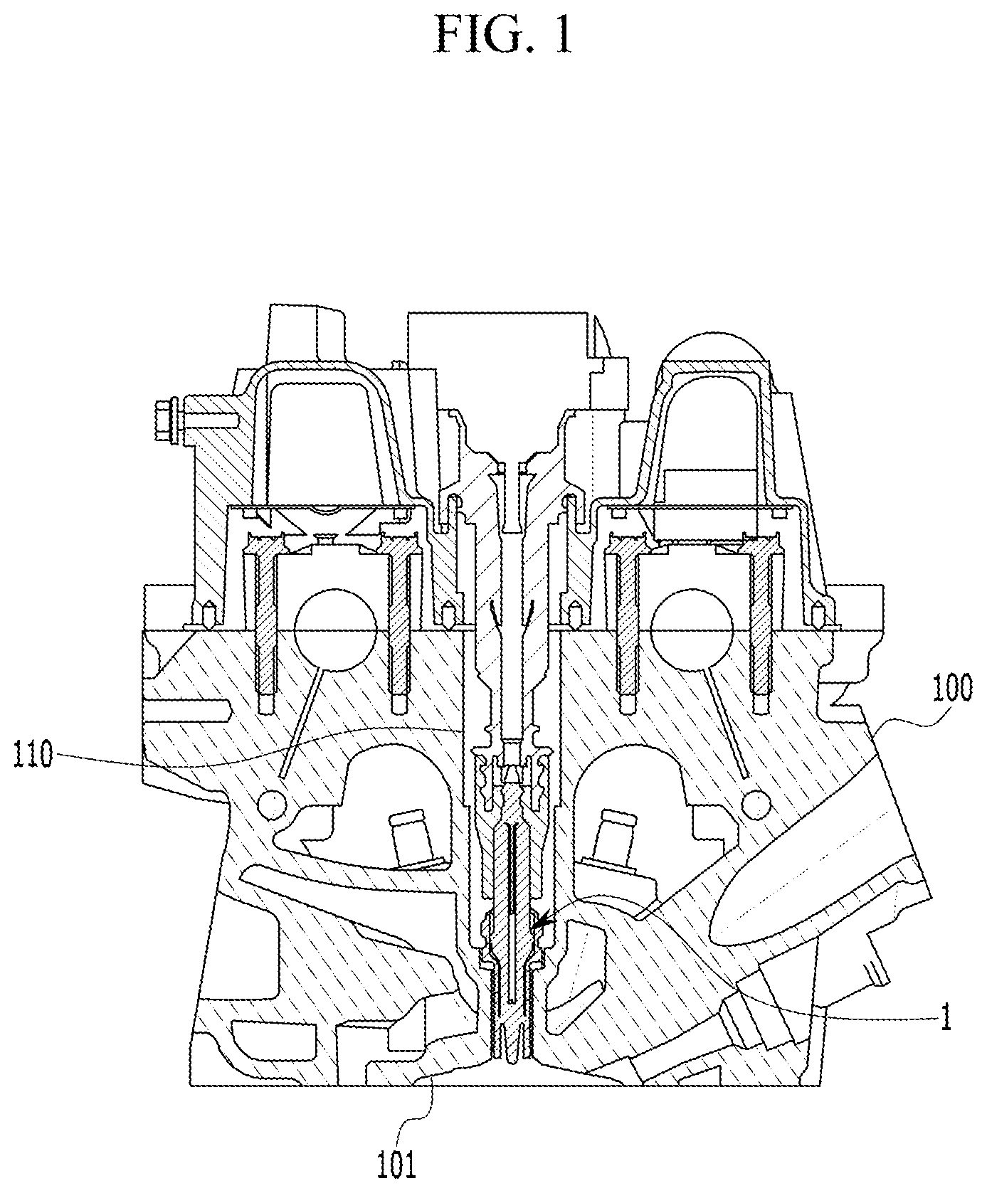 Patent US11781517 Figure 1 – Electrode wear amount predicting system and method of spark plug