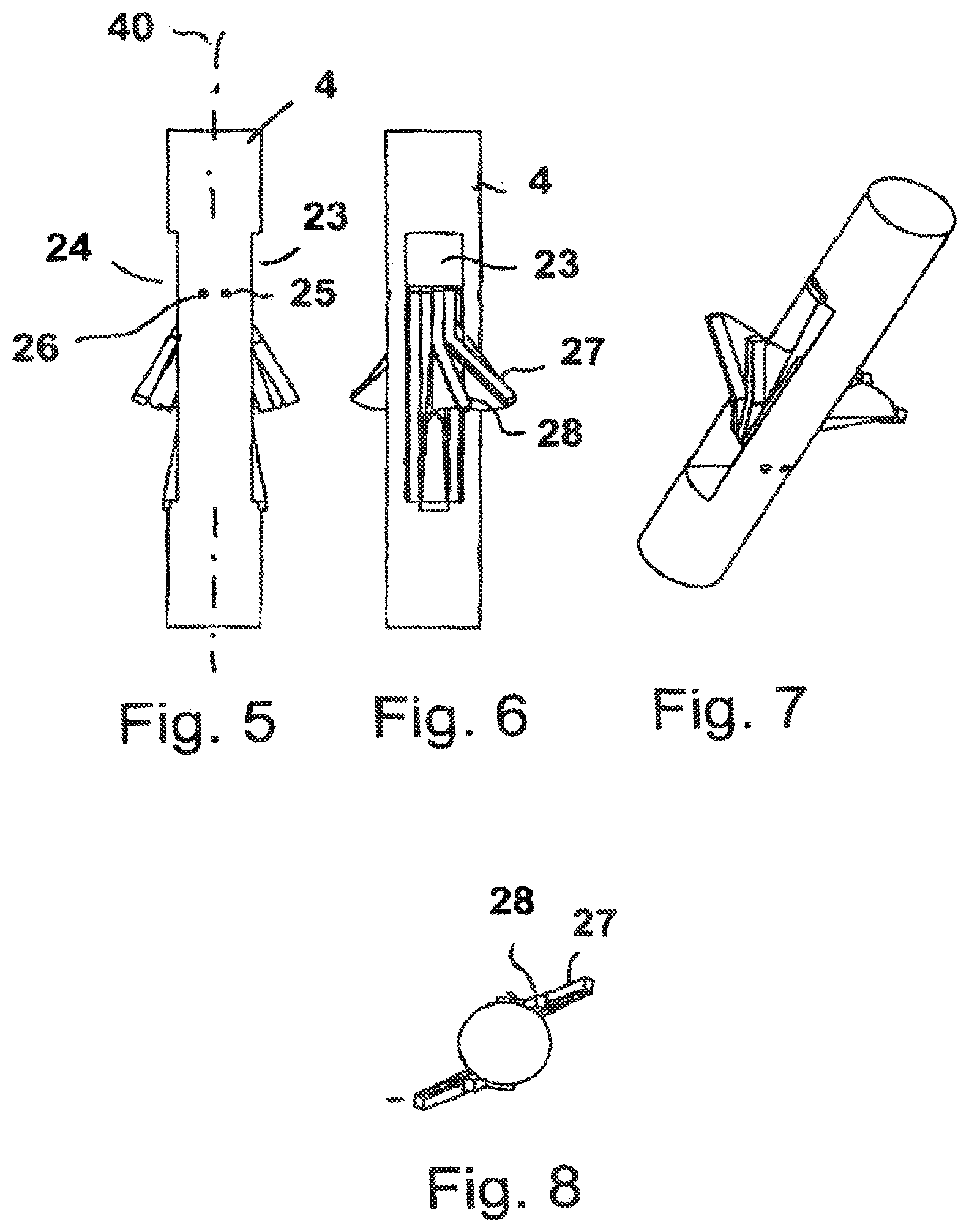 Patent US11781557 Figure 3 – Radially compressible and expandable rotor for a fluid pump