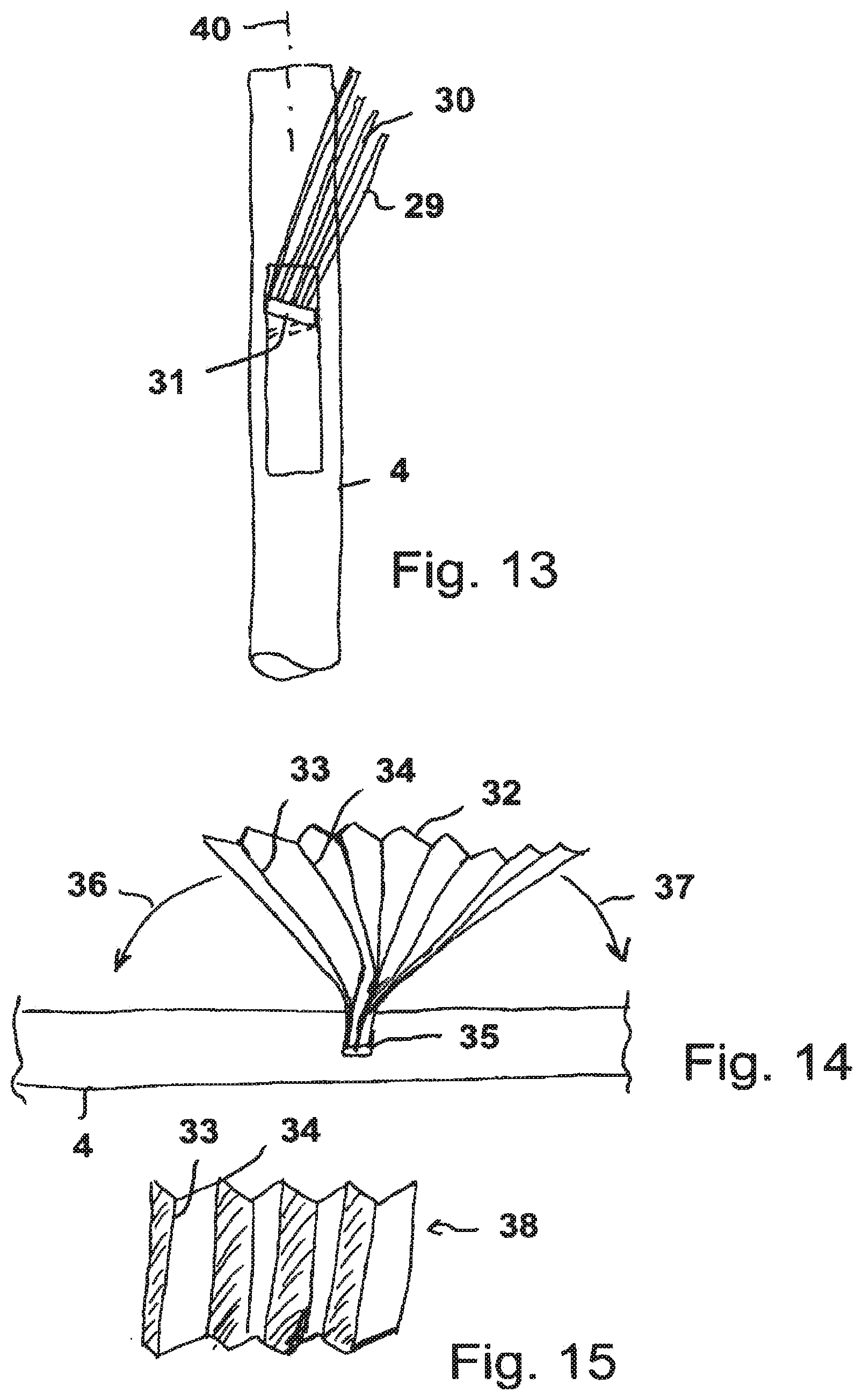 Patent US11781557 Figure 5 – Radially compressible and expandable rotor for a fluid pump