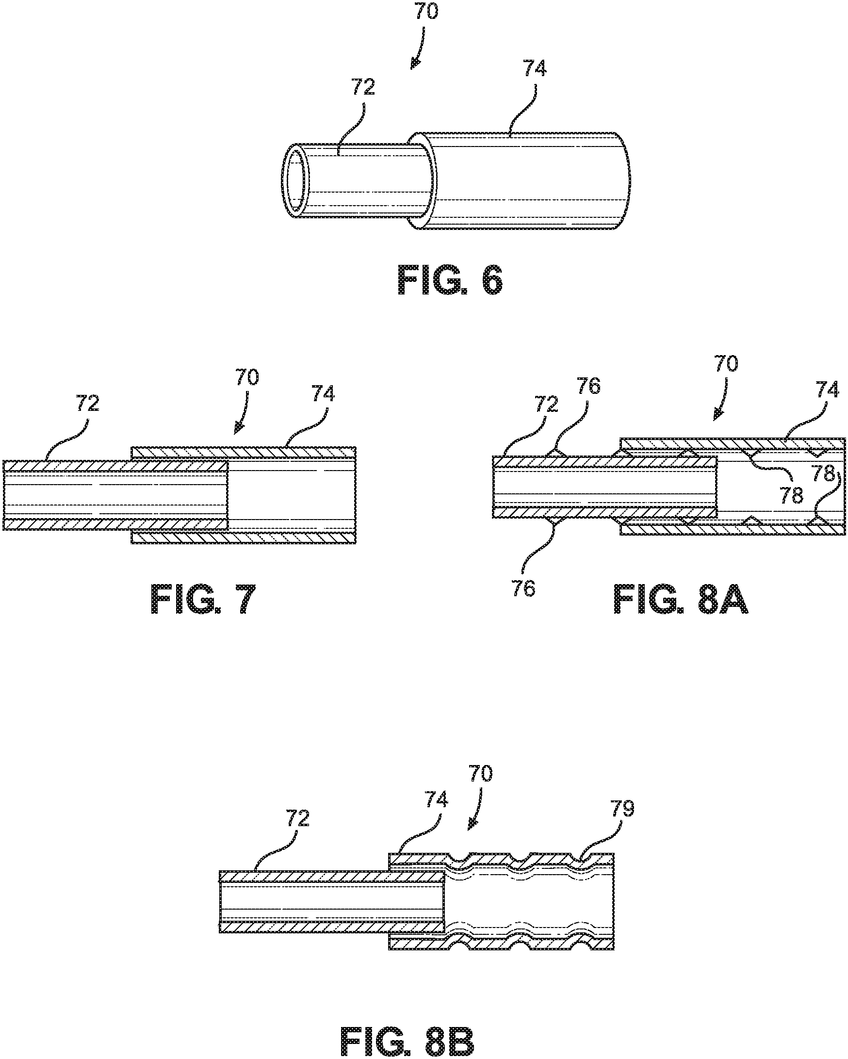 Patent US11781579 Figure 3 – Blind bolt with collapsible shear sleeve assembly