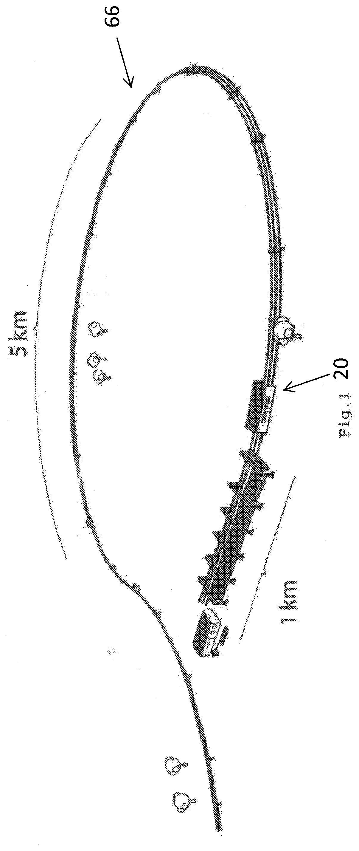 Patent US11781675 Figure 1 – Method for manufacture, assembly and continuous construction of pipe sections in a spoolbase with gradual movement