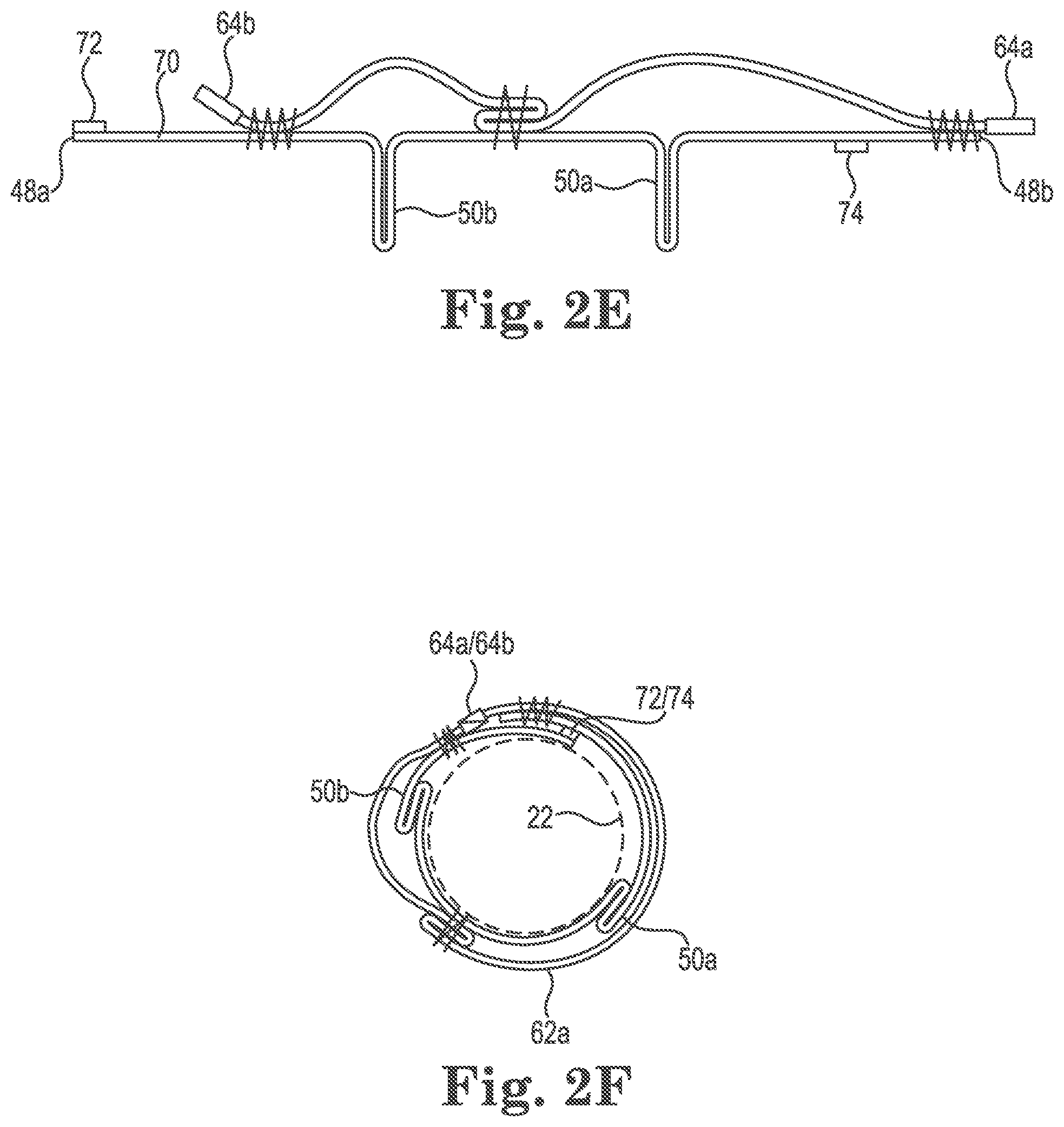 Patent US11781681 Figure 4 – Containment sleeve for pressurized piping system