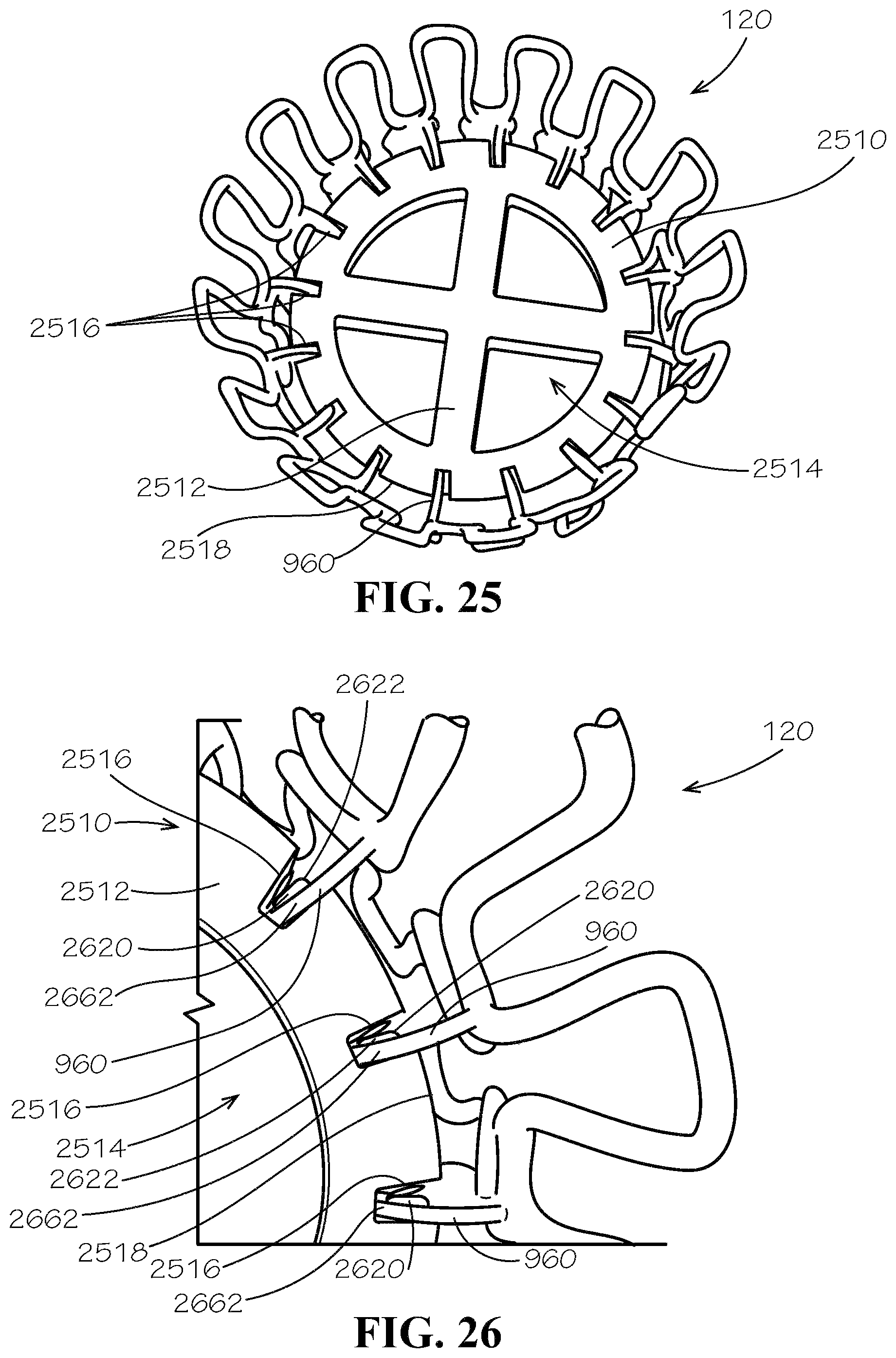 Patent US11781697 Figure 17 – Stent springs and stents for repairing pipes