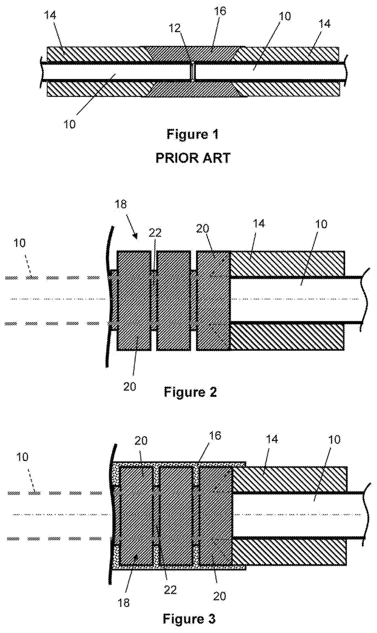 Patent US11781700 Figure 1 – Insulating inserts for field joints of coated rigid pipelines