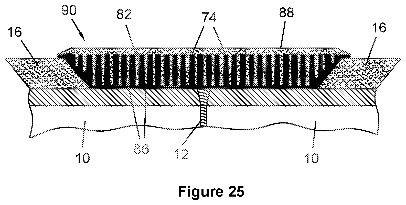 Patent US11781700 Figure 11 – Insulating inserts for field joints of coated rigid pipelines
