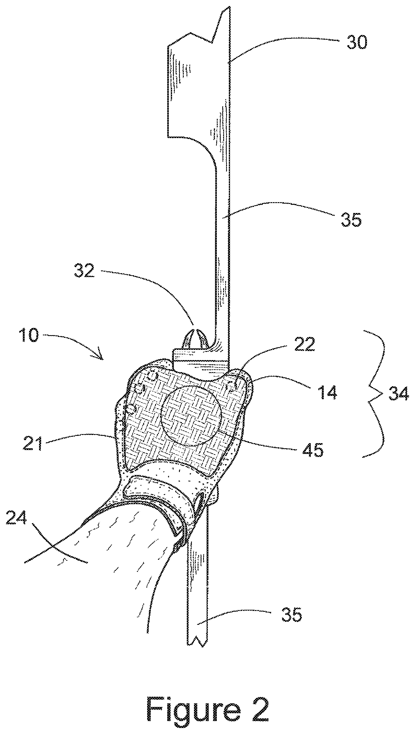 Patent US11781830 Figure 2 – Protective glove for archery shooting