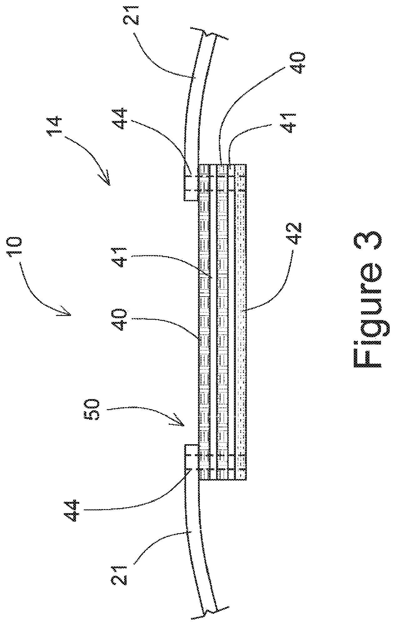 Patent US11781830 Figure 3 – Protective glove for archery shooting