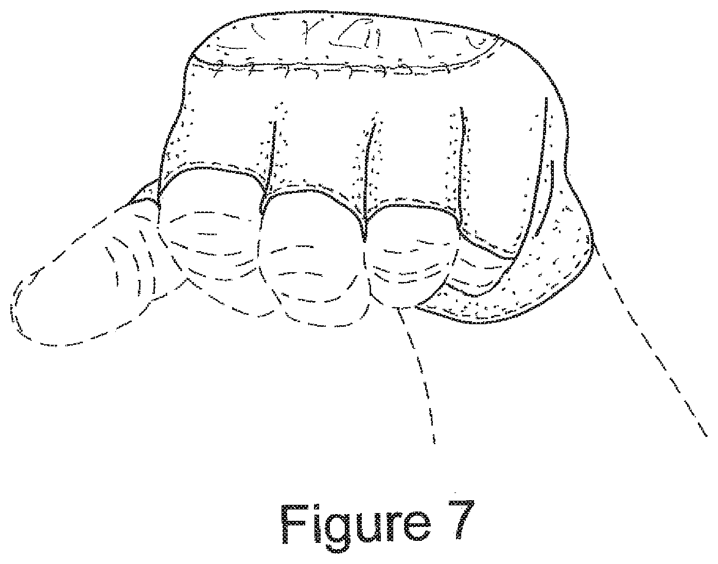 Patent US11781830 Figure 7 – Protective glove for archery shooting