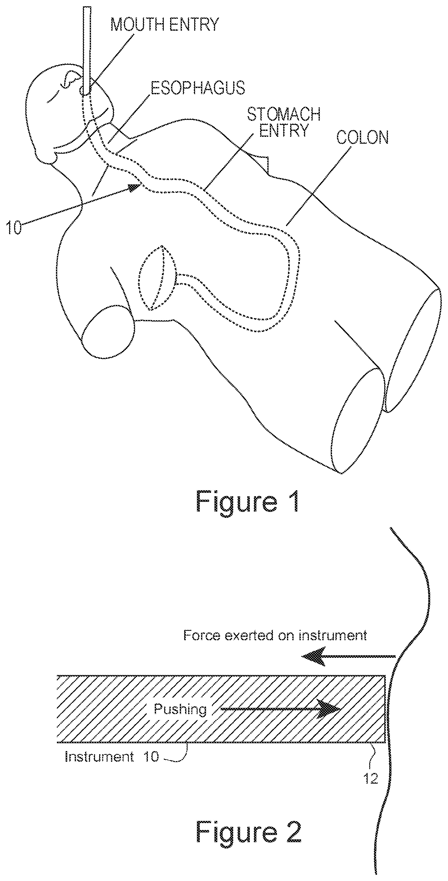 Patent US11781857 Figure 1 – Force sensing in a distal region of an instrument including single-core or multi-core optical fiber