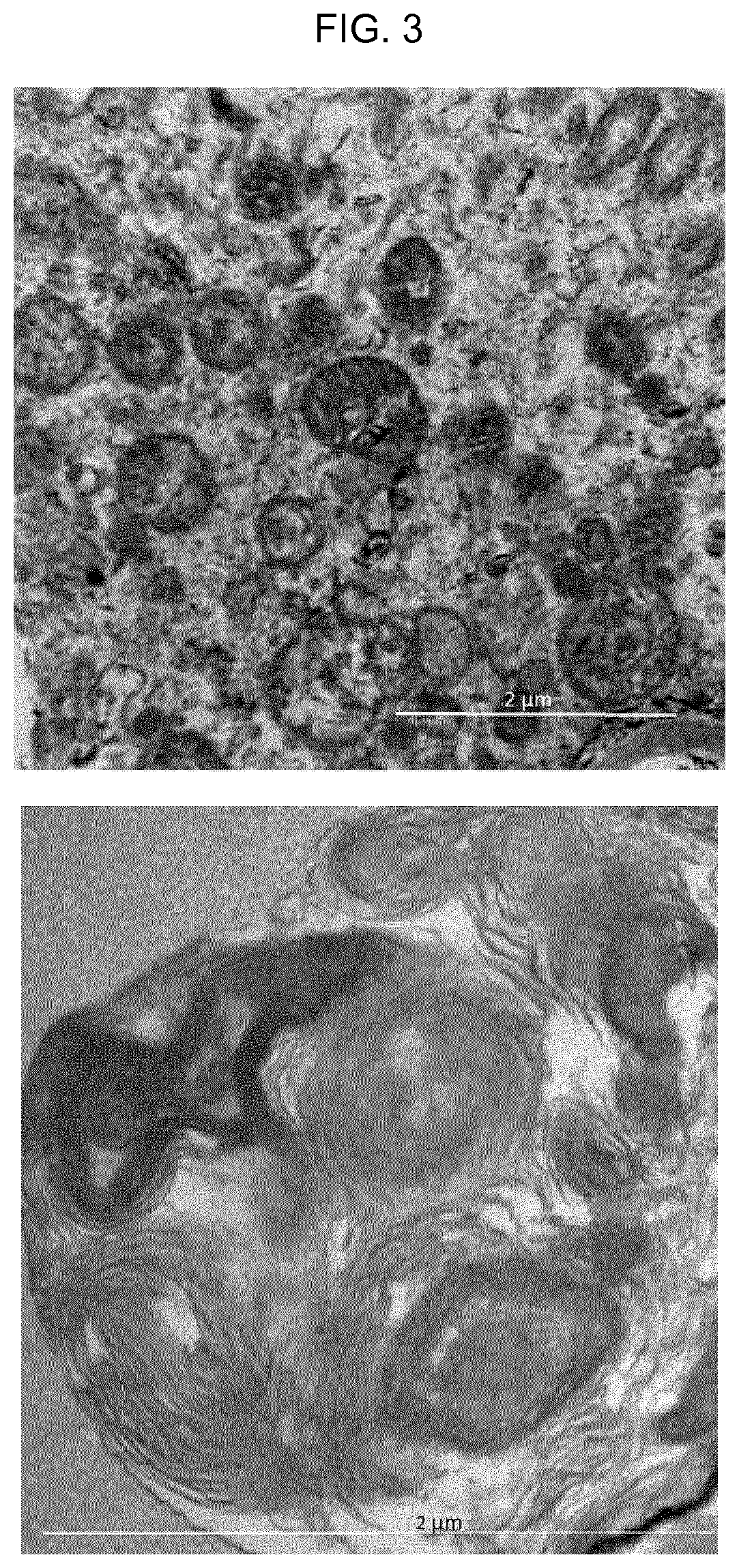 Patent US11781980 Figure 3 – Fetal lung maturity test