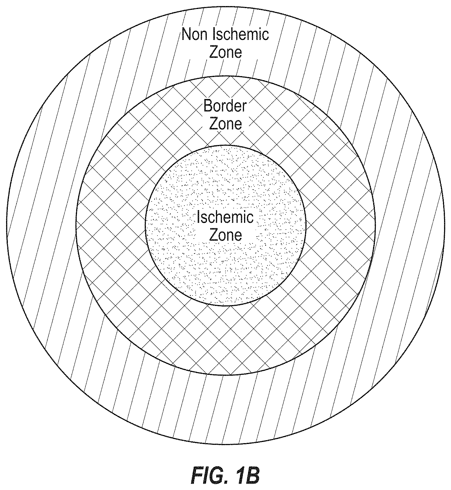 Patent US11782051 Figure 2 – Systems and methods for reperfusion injury