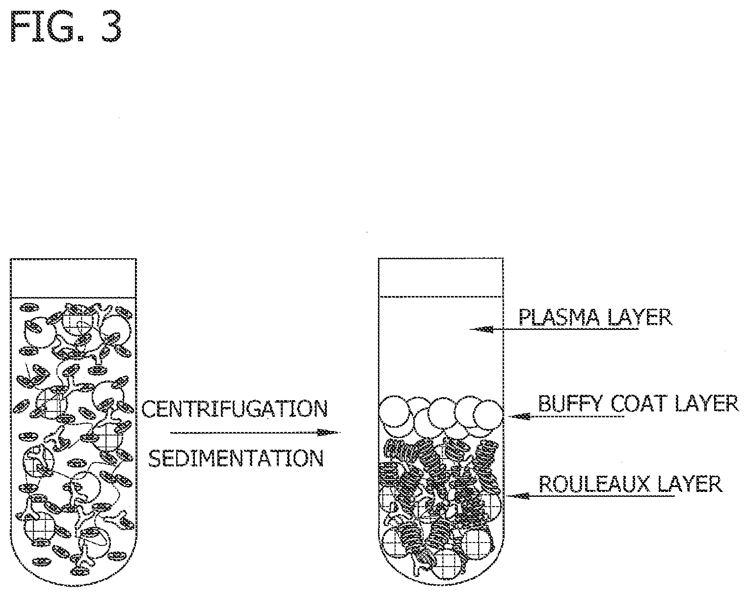 Patent US11782054 Figure 3 – Antibody-linked immuno-sedimentation agent and method of isolating a target form a sample using same