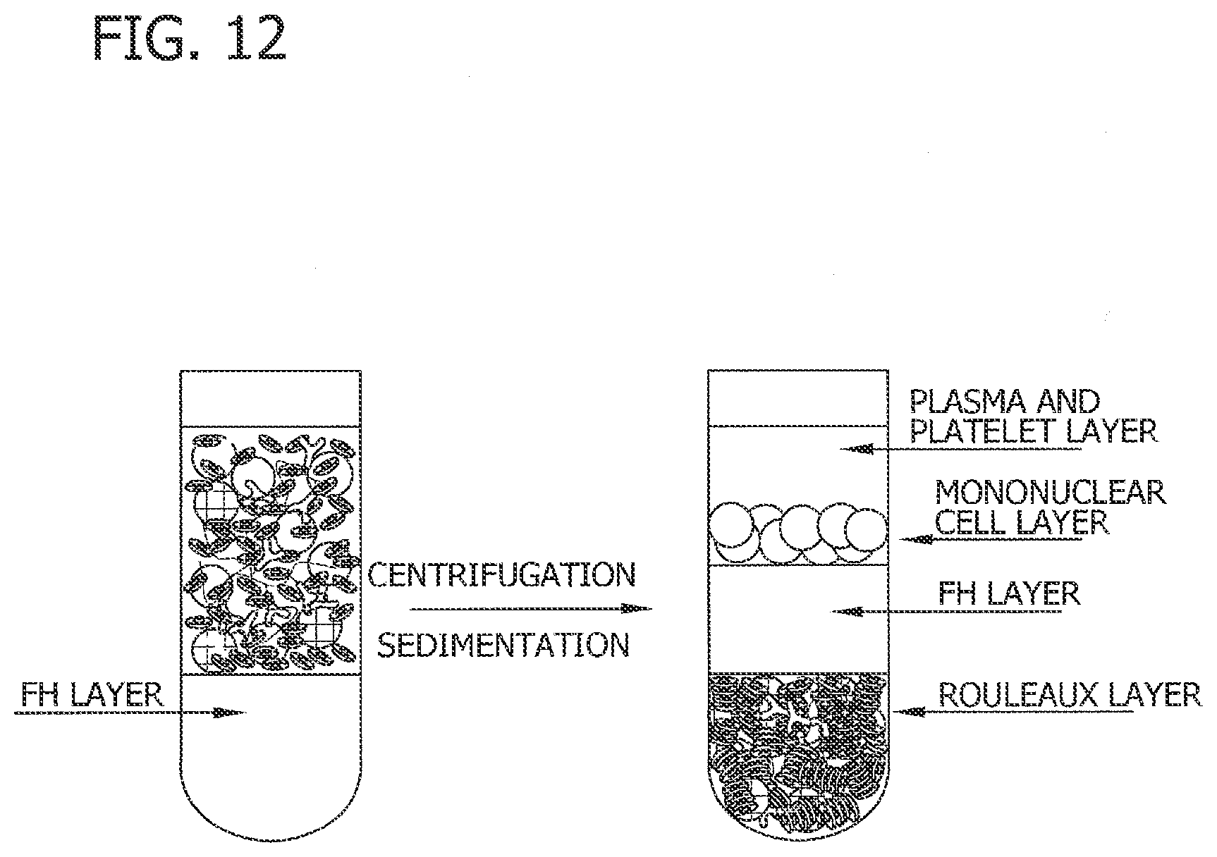 Patent US11782054 Figure 12 – Antibody-linked immuno-sedimentation agent and method of isolating a target form a sample using same