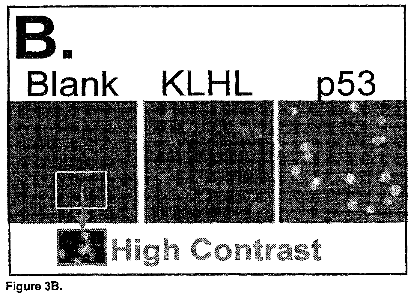 Patent US11782056 Figure 4 – Global proteomic screening of random bead arrays using mass spectrometry imaging